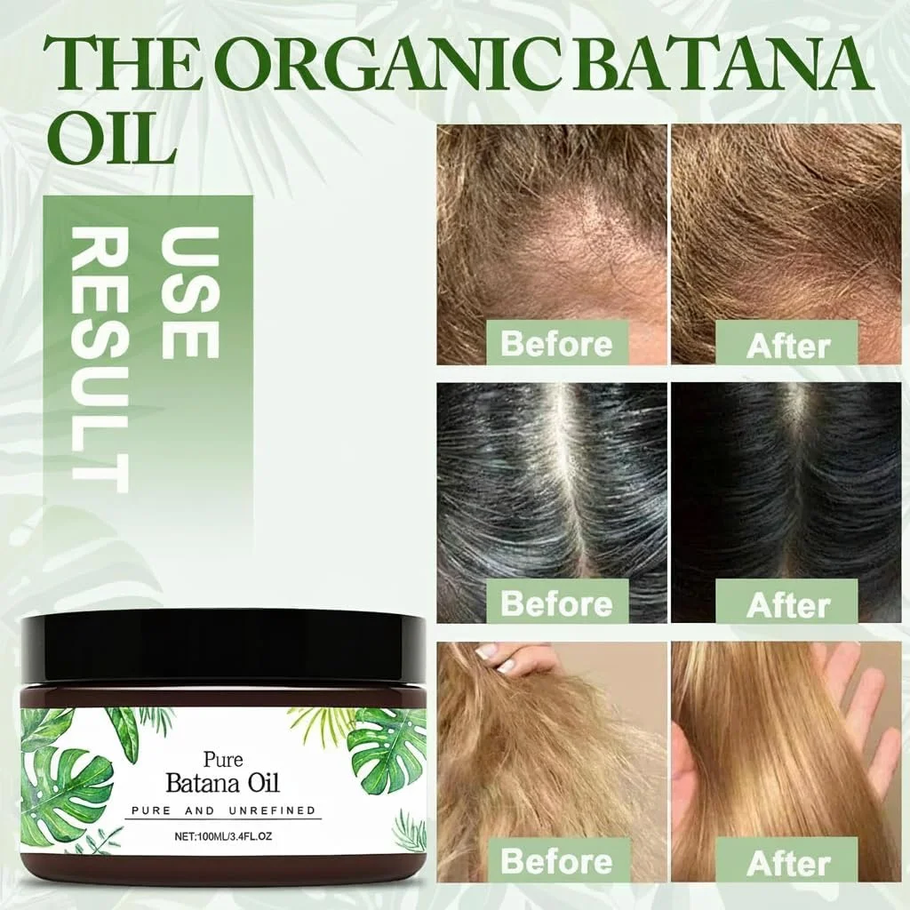 ماسک مو روغن باتانا، 2 بطری روغن باتانا برای رشد مو، سرم مغذی مو برای موهای آسیب دیده، جلوگیری از ریزش مو و موخوره، ترمیم عمقی برای انواع مو مردان و زنان ماسک مو روغن باتانا، 2 بطری روغن باتانا برای رشد مو، سرم مغذی مو برای موهای آسیب دیده، جلوگیری از ریزش مو و موخوره، ترمیم عمقی برای انواع مو مردان و زنان