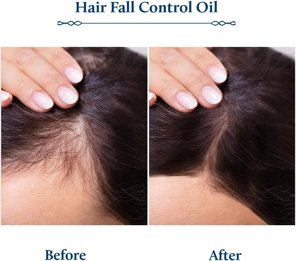 روغن کنترل ریزش مو و تقویت کننده پوست سر بریگانانتادی بلو نکتار | روغن موی غیر چسبنده برای رشد مو | روغن ضد ریزش موی ایده آل برای زنان و مردان (9 گیاه، 200 میلی لیتر) روغن کنترل ریزش مو و تقویت کننده پوست سر بریگانانتادی بلو نکتار | روغن موی غیر چسبنده برای رشد مو | روغن ضد ریزش موی ایده آل برای زنان و مردان (9 گیاه، 200 میلی لیتر)