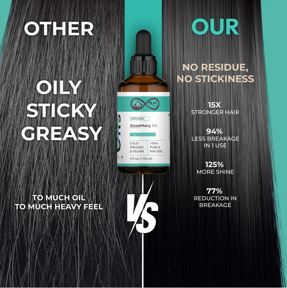 روغن مو رزماری بلک هربز غنی شده با روغن جوجوبا، بادام، کرچک، آووکادو، نارگیل، زیتون و دانه سیاه | برای رشد مو، مراقبت از ریش، تغذیه ناخن و مژه، ضد ریزش مو، ضد وز روغن مو رزماری بلک هربز غنی شده با روغن جوجوبا، بادام، کرچک، آووکادو، نارگیل، زیتون و دانه سیاه | برای رشد مو، مراقبت از ریش، تغذیه ناخن و مژه، ضد ریزش مو، ضد وز