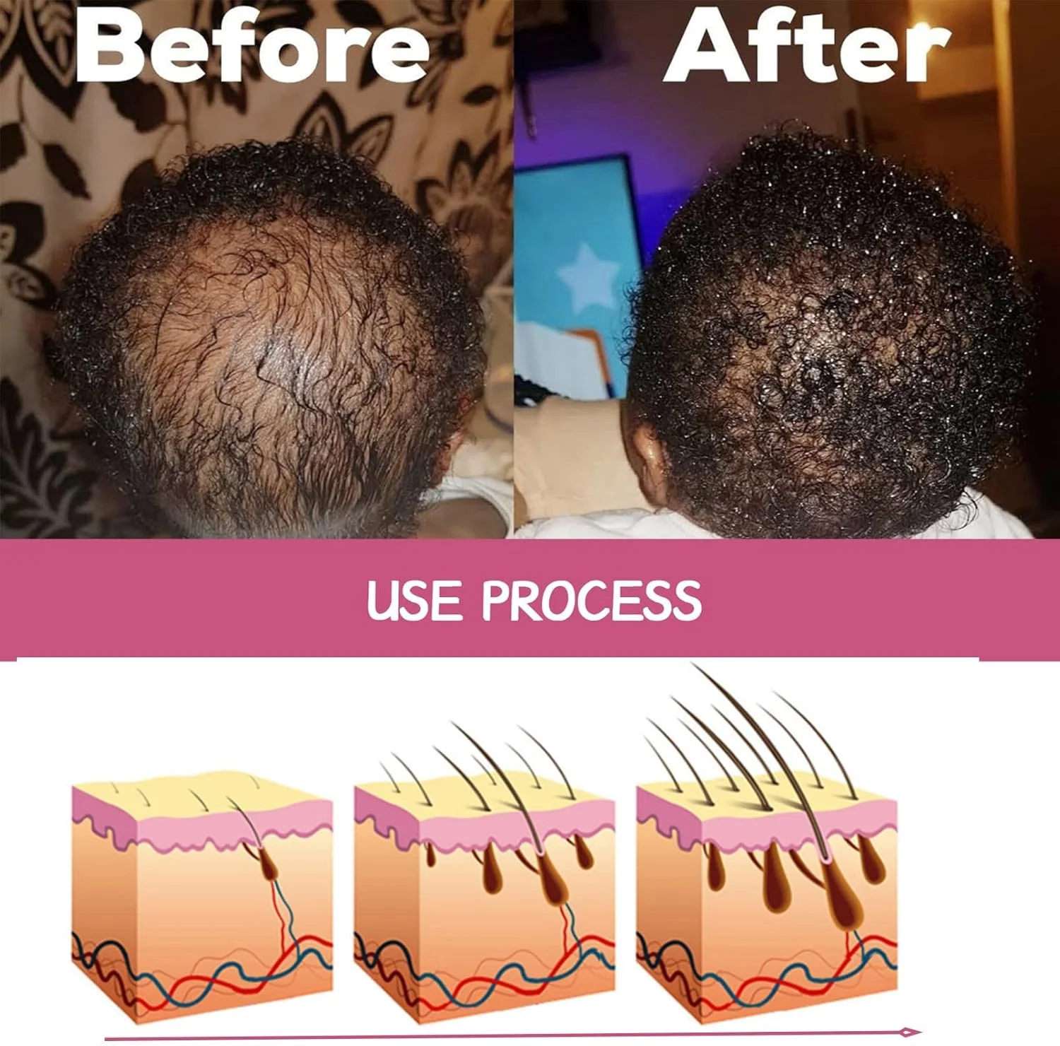 کره مو حاوی روغن باتانا 100% خالص و خام، روغن باتانا از هندوراس برای رشد مو، مرطوب کننده مو و پوست سر، مناسب برای انواع مو، ترمیم موهای آسیب دیده، 60 گرم کره مو حاوی روغن باتانا 100% خالص و خام، روغن باتانا از هندوراس برای رشد مو، مرطوب کننده مو و پوست سر، مناسب برای انواع مو، ترمیم موهای آسیب دیده، 60 گرم