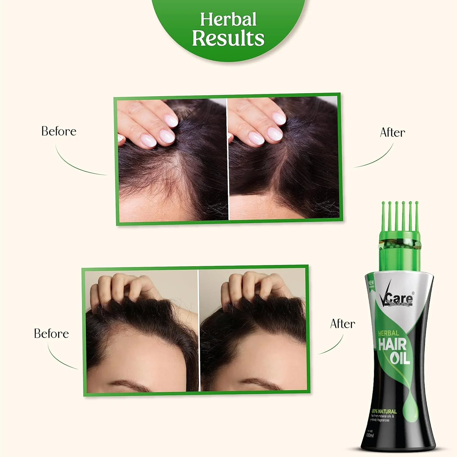 روغن موی گیاهی جدید و بهبود یافته Vcare با کلاه شگفت انگیز (100 میلی لیتر، بسته 2 عددی) روغن موی گیاهی جدید و بهبود یافته Vcare با کلاه شگفت انگیز (100 میلی لیتر، بسته 2 عددی)