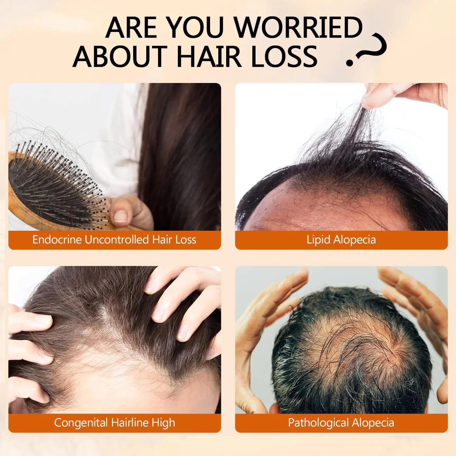 سرم تقویت کننده و افزایش تراکم مو LBOYLOVE® (دو عدد)، روغن ضروری طبیعی برای بهبود موهای نازک برای مردان و زنان، کاهش ریزش مو، شکستگی، خشکی و وز شدن، ترمیم موهای آسیب دیده، 35 میلی لیتر