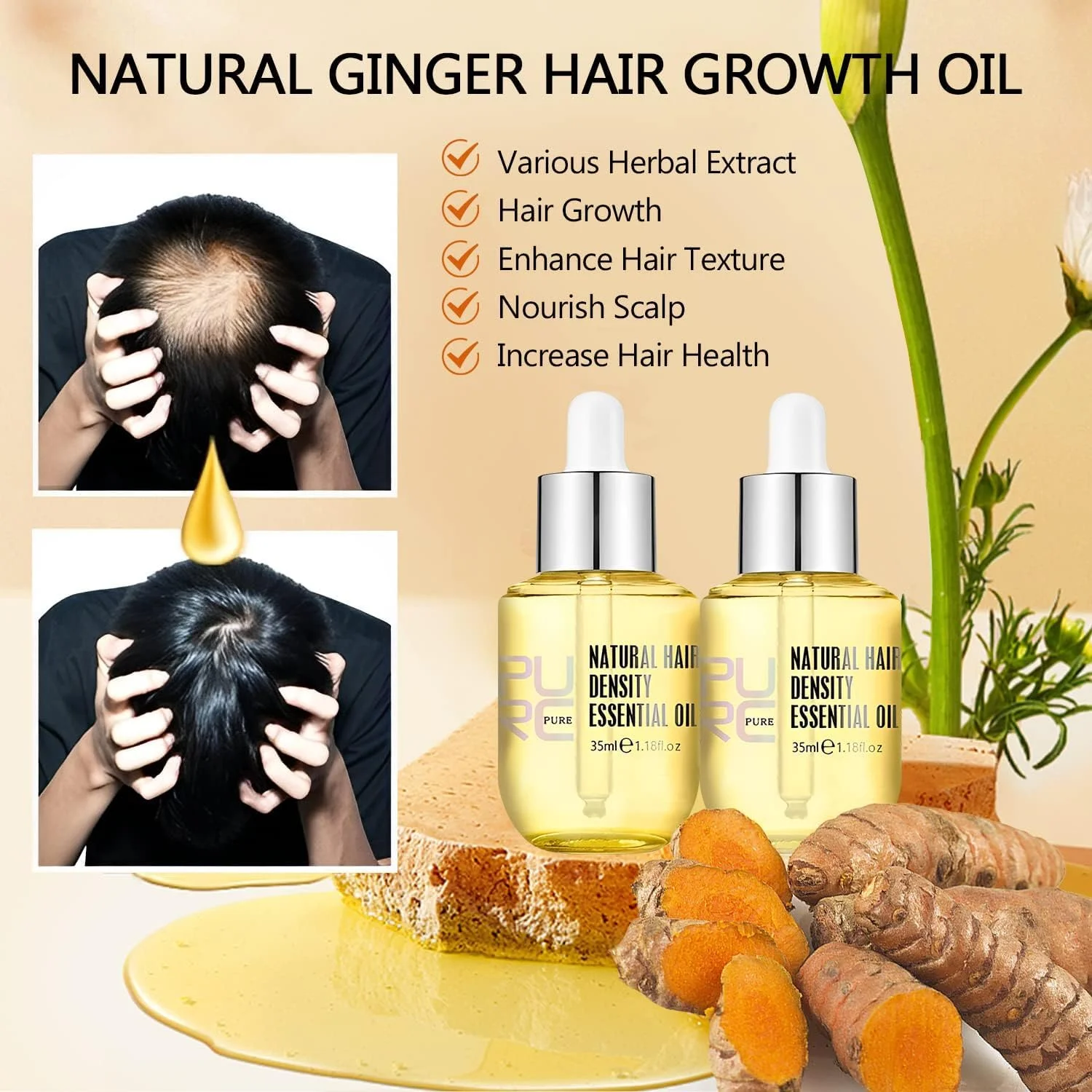 سرم تقویت کننده و افزایش تراکم مو LBOYLOVE® (دو عدد)، روغن ضروری طبیعی برای بهبود موهای نازک برای مردان و زنان، کاهش ریزش مو، شکستگی، خشکی و وز شدن، ترمیم موهای آسیب دیده، 35 میلی لیتر