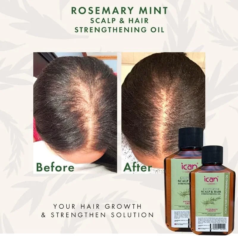 روغن درمان پوست سر و مو رزماری و نعناع ican London برای رشد سریعتر مو 50 میلی لیتر روغن درمان پوست سر و مو رزماری و نعناع ican London برای رشد سریعتر مو 50 میلی لیتر