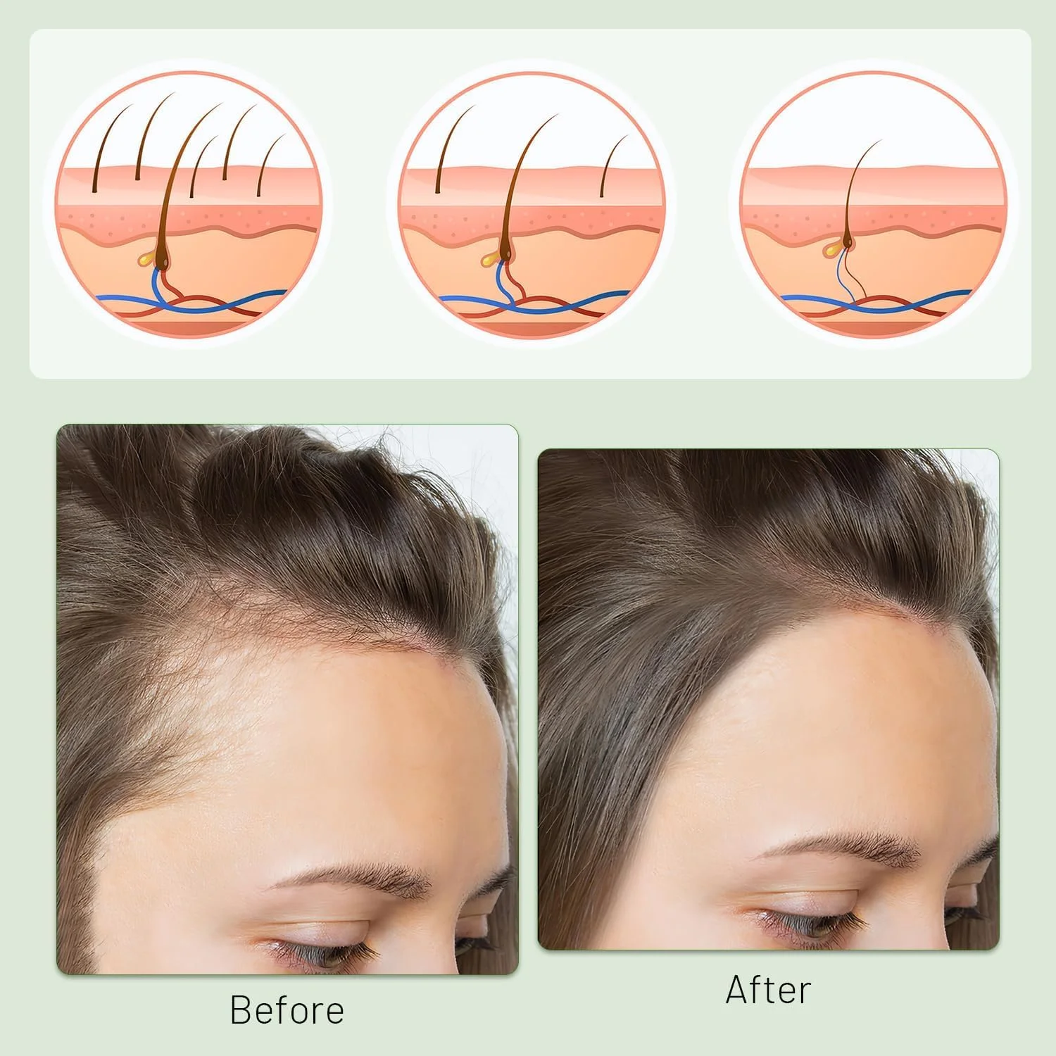 روغن و پودر رشد مو 10 در 1 نالاکال، تقویت رشد مو، کاهش ریزش مو، تقویت و تغذیه برای موهایی پرپشت تر و سالم تر روغن و پودر رشد مو 10 در 1 نالاکال، تقویت رشد مو، کاهش ریزش مو، تقویت و تغذیه برای موهایی پرپشت تر و سالم تر