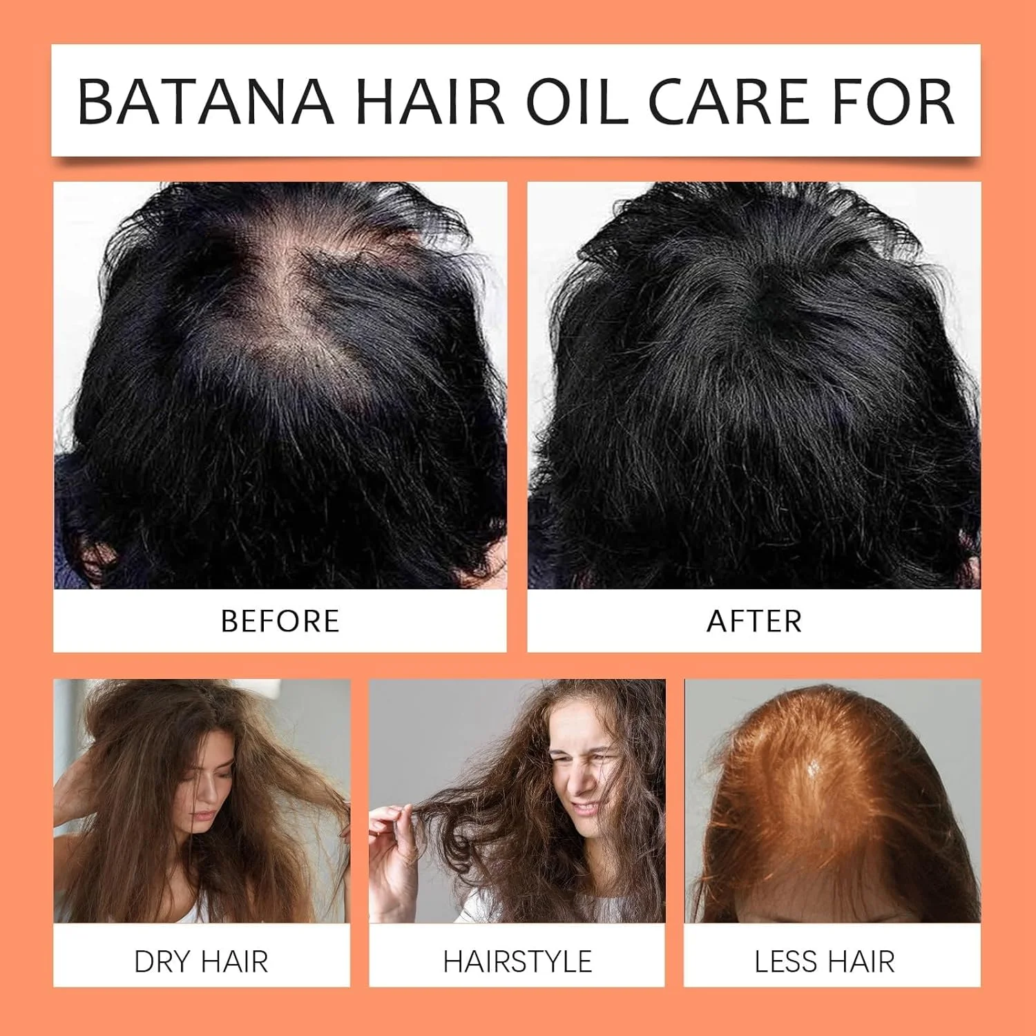 روغن باتانا آزونی برای رشد و تغذیه مو، کاهش خشکی و زبری، روغن موی باتانا خالص برای موهای قوی تر، نرم تر و براق تر، و ضخیم شدن مو، از بین برنده موخوره برای آقایان و بانوان روغن باتانا آزونی برای رشد و تغذیه مو، کاهش خشکی و زبری، روغن موی باتانا خالص برای موهای قوی تر، نرم تر و براق تر، و ضخیم شدن مو، از بین برنده موخوره برای آقایان و بانوان