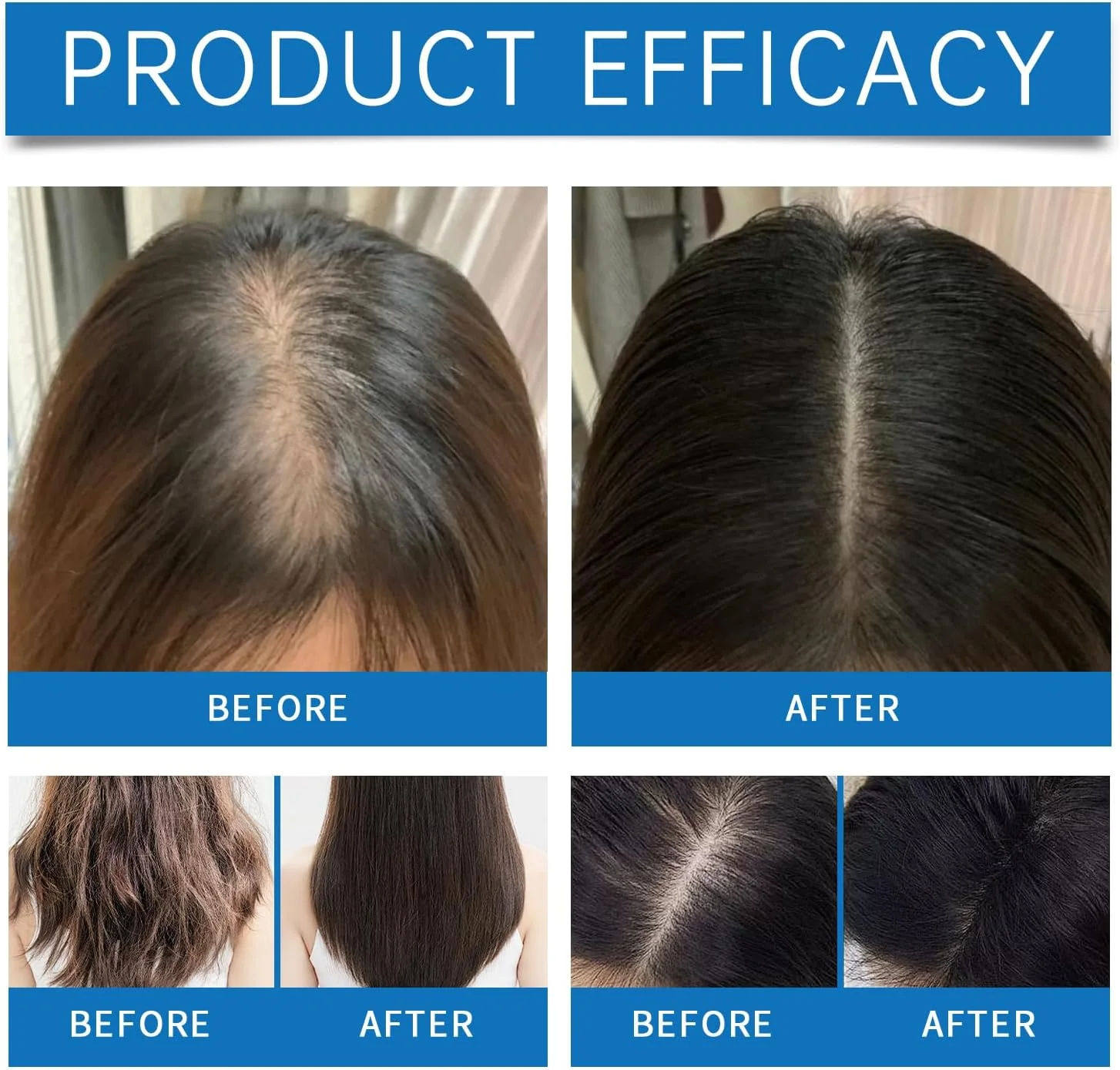 روغن تقویت کننده مو و پوست سر، تسکین دهنده و طراوت بخش پوست سر تحریک شده، تقویت کننده ریشه مو، کاهش دهنده ریزش مو، افزایش دهنده حجم و سلامت مو، ایده آل برای موهای نازک و ضعیف روغن تقویت کننده مو و پوست سر، تسکین دهنده و طراوت بخش پوست سر تحریک شده، تقویت کننده ریشه مو، کاهش دهنده ریزش مو، افزایش دهنده حجم و سلامت مو، ایده آل برای موهای نازک و ضعیف