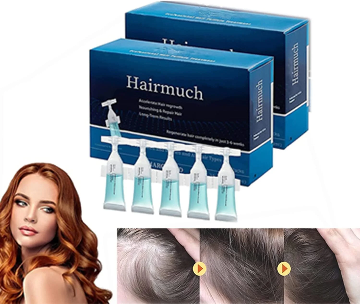 سرم لوسیون آمپول رشد مو Hair-Much، سرم رشد مو، آمپول های درمان سرم ضد ریزش مو، سرم رشد مو Hair-Much (2 جعبه) سرم لوسیون آمپول رشد مو Hair-Much، سرم رشد مو، آمپول های درمان سرم ضد ریزش مو، سرم رشد مو Hair-Much (2 جعبه)