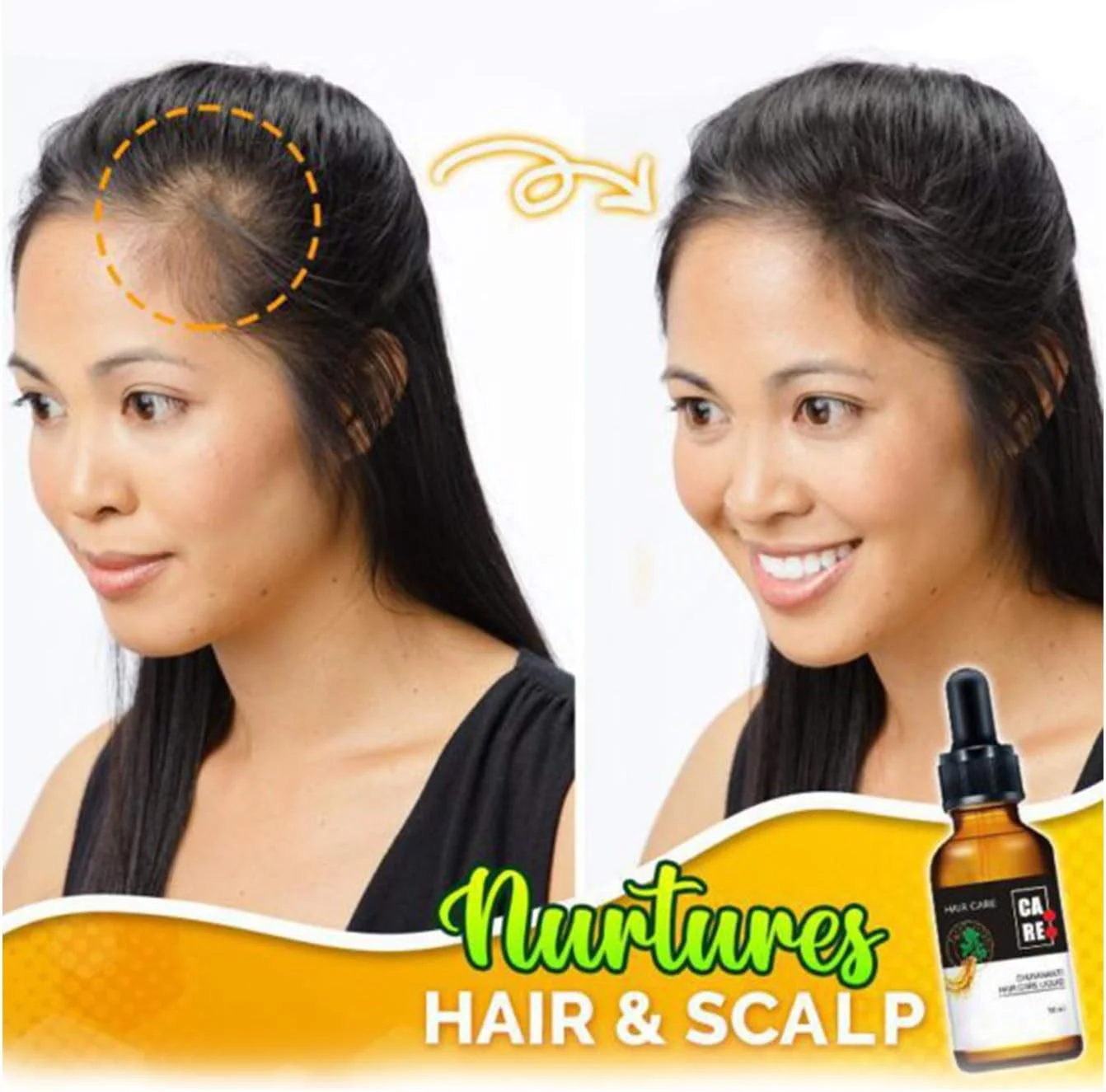 سرم موی قوی 10X-Regro با 50% تخفیف، سرم رشد مو، غنی شده با مواد مغذی طبیعی ریشه آنجلیکا، ترمیم کننده فولیکول های مو، نازک شدن مو، طاسی، تقویت کننده ضخامت مو سرم موی قوی 10X-Regro با 50% تخفیف، سرم رشد مو، غنی شده با مواد مغذی طبیعی ریشه آنجلیکا، ترمیم کننده فولیکول های مو، نازک شدن مو، طاسی، تقویت کننده ضخامت مو