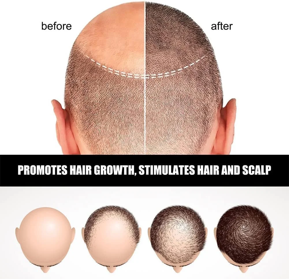 سرم لوسیون آمپول رشد مو Hair-Much، سرم رشد مو، آمپول های درمان سرم ضد ریزش مو، سرم رشد مو Hair-Much (2 جعبه) سرم لوسیون آمپول رشد مو Hair-Much، سرم رشد مو، آمپول های درمان سرم ضد ریزش مو، سرم رشد مو Hair-Much (2 جعبه)