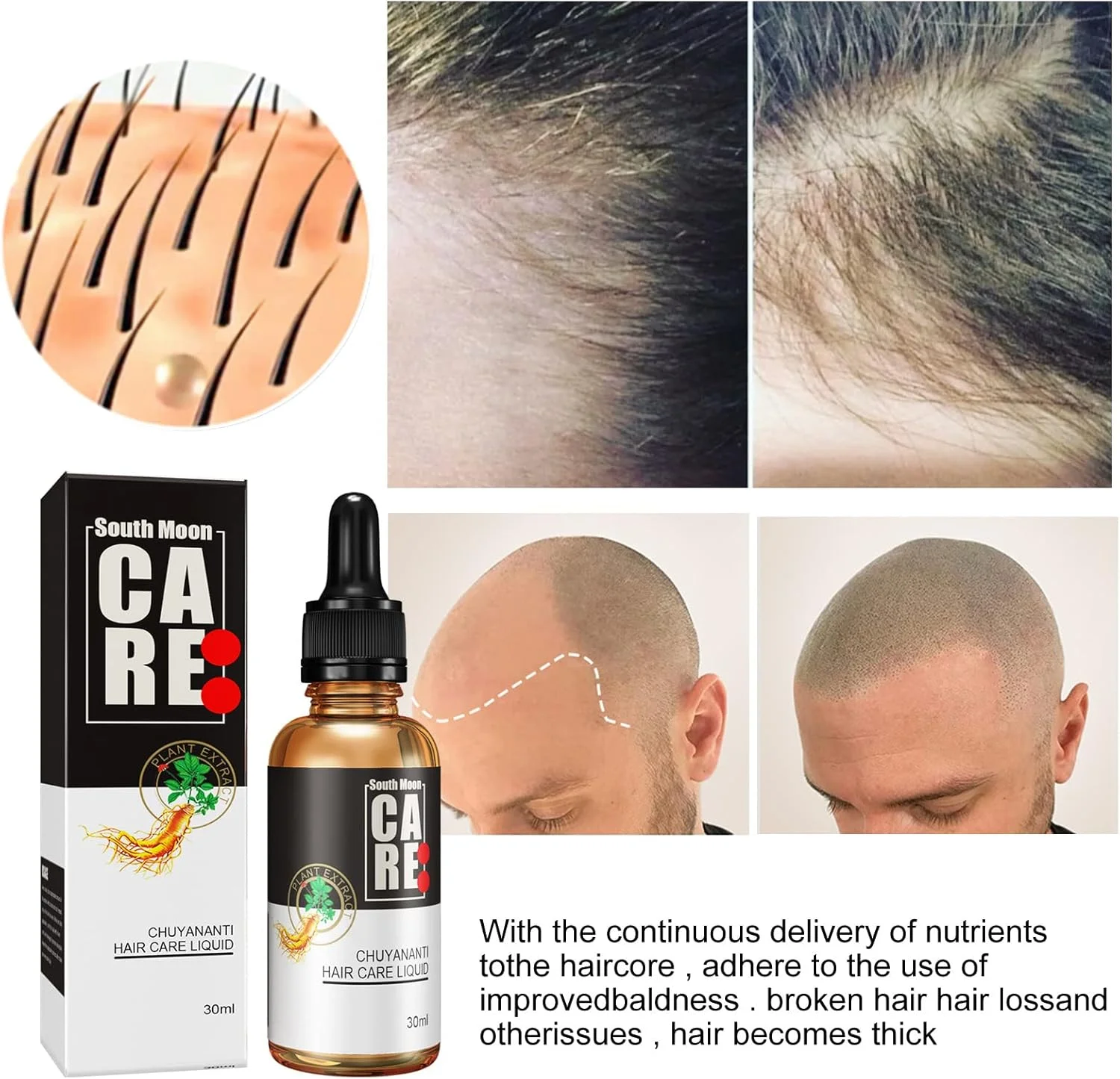 سرم موی قوی 10X-Regro، روغن اسانس سرم رشد مو، برای موهای قوی تر، ضخیم تر و بلندتر برای مردان و زنان، ترمیم فولیکول های مو، نازک شدن مو، طاسی (60 میلی لیتر)