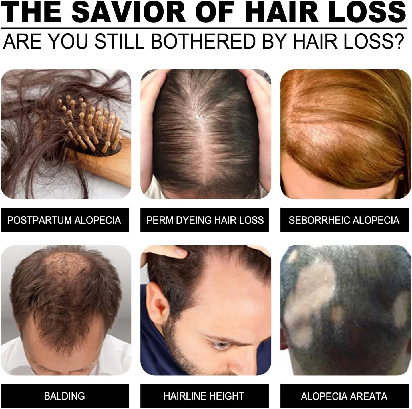 سرم موی قوی 10X-Regro، روغن اسانس سرم رشد مو، برای موهای قوی تر، ضخیم تر و بلندتر برای مردان و زنان، ترمیم فولیکول های مو، نازک شدن مو، طاسی (60 میلی لیتر)