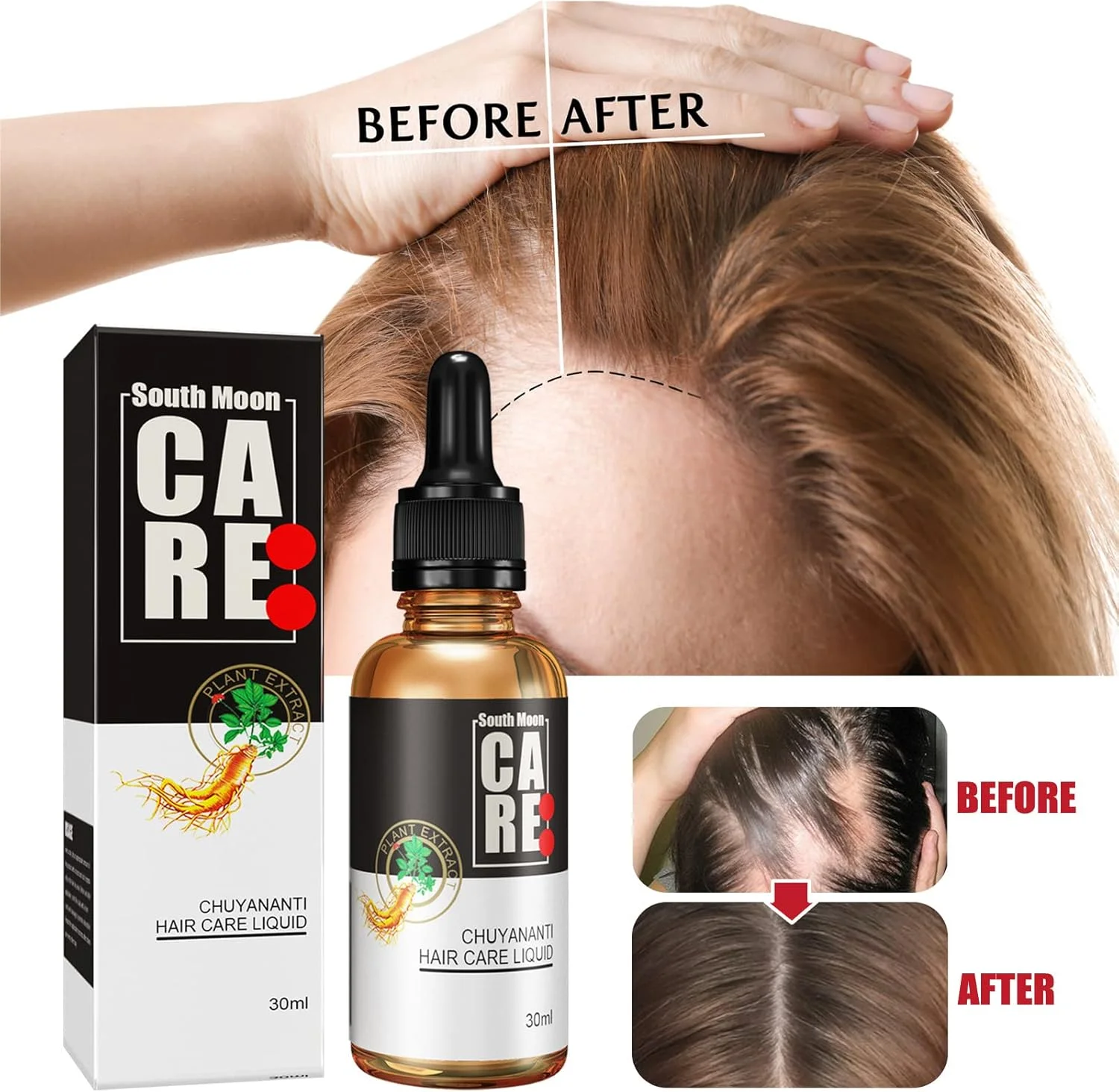 سرم موی قوی 10X-Regro، روغن اسانس سرم رشد مو، برای موهای قوی تر، ضخیم تر و بلندتر برای مردان و زنان، ترمیم فولیکول های مو، نازک شدن مو، طاسی (60 میلی لیتر)