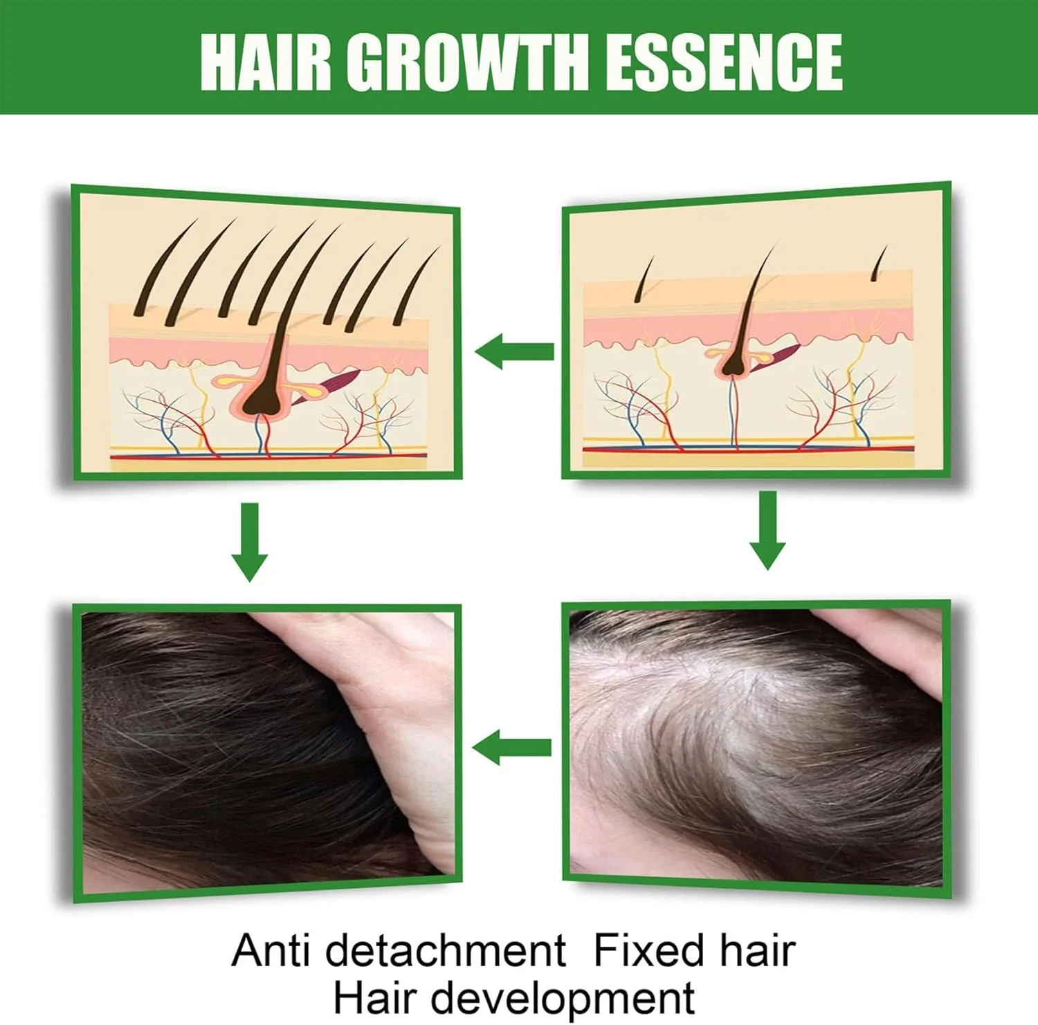 سرم ترمیم و رشد مو زنجبیلی، اسپری تقویت کننده مو آزونی برای جلوگیری از ریزش مو، نازک شدن، خشکی و آسیب دیدگی مو، محلول رشد مجدد، فرمول مغذی با عصاره زنجبیل و گیاهان سرم ترمیم و رشد مو زنجبیلی، اسپری تقویت کننده مو آزونی برای جلوگیری از ریزش مو، نازک شدن، خشکی و آسیب دیدگی مو، محلول رشد مجدد، فرمول مغذی با عصاره زنجبیل و گیاهان