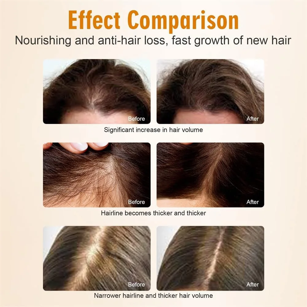 سرم رشد مو زنجبیلی آزونی، درمان 100% طبیعی برای رشد مجدد مو برای مردان و زنان، کاهش دهنده نازک شدن، ریزش مو، شوره سر و خشکی پوست سر، تغذیه کننده و تقویت کننده مو، 60 میلی لیتر سرم رشد مو زنجبیلی آزونی، درمان 100% طبیعی برای رشد مجدد مو برای مردان و زنان، کاهش دهنده نازک شدن، ریزش مو، شوره سر و خشکی پوست سر، تغذیه کننده و تقویت کننده مو، 60 میلی لیتر