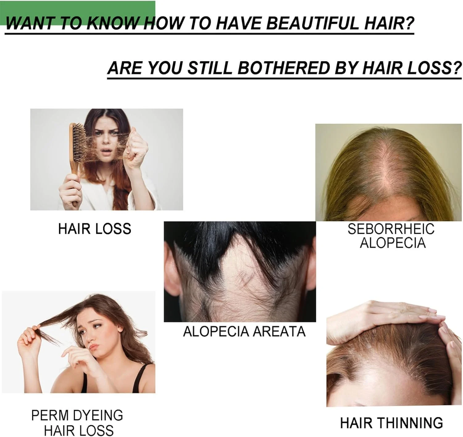 سرم ترمیم و رشد مو زنجبیلی، اسپری تقویت کننده مو آزونی برای جلوگیری از ریزش مو، نازک شدن، خشکی و آسیب دیدگی مو، محلول رشد مجدد، فرمول مغذی با عصاره زنجبیل و گیاهان سرم ترمیم و رشد مو زنجبیلی، اسپری تقویت کننده مو آزونی برای جلوگیری از ریزش مو، نازک شدن، خشکی و آسیب دیدگی مو، محلول رشد مجدد، فرمول مغذی با عصاره زنجبیل و گیاهان