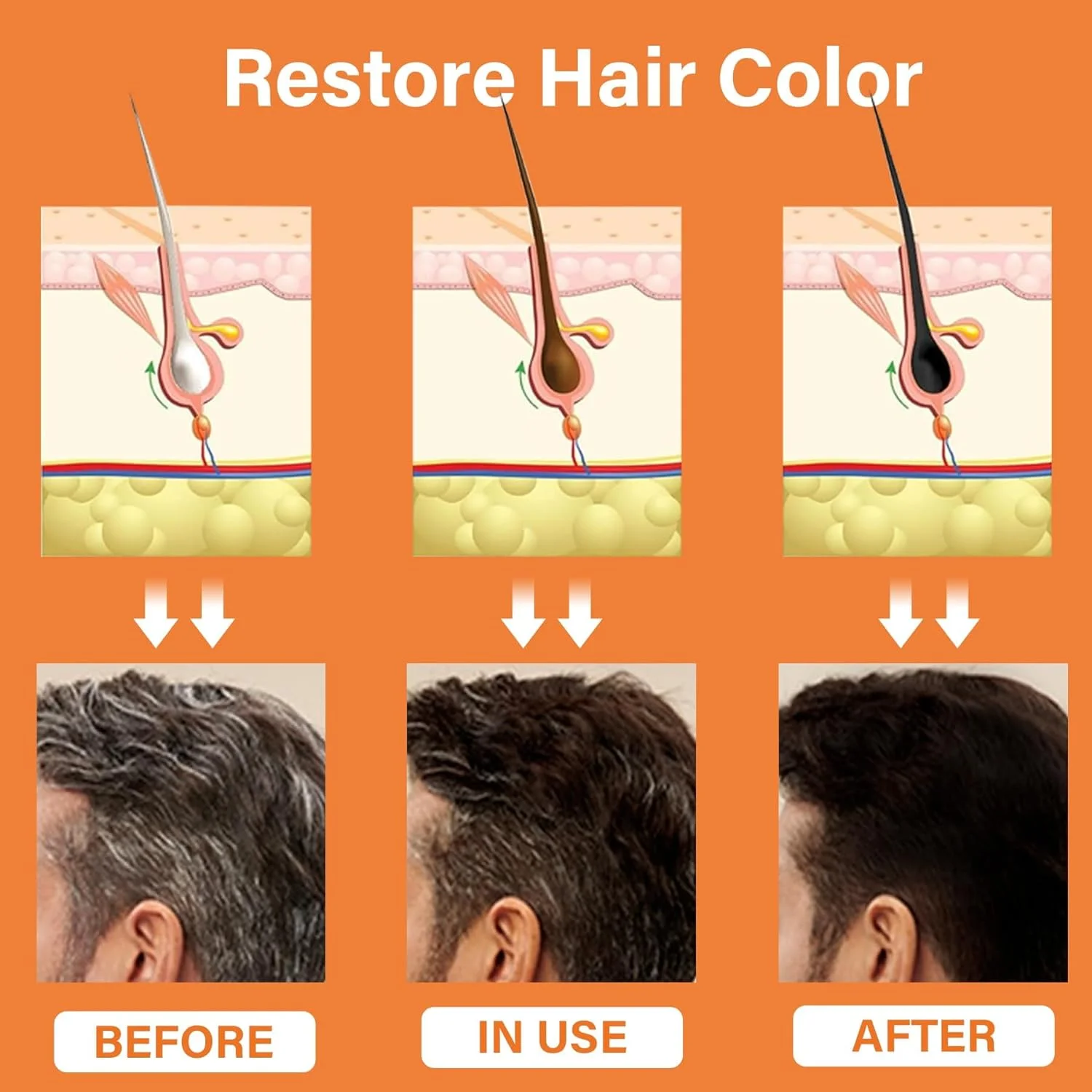 اسپری گیاهی معکوس کننده موهای سفید، سرم نرم کننده مو آزونی Polygonum Multiflorum برای رشد و تیره شدن مو، تقویت کننده رشد مو، کاهش دهنده نازک شدن و ریزش مو، برای آقایان و بانوان اسپری گیاهی معکوس کننده موهای سفید، سرم نرم کننده مو آزونی Polygonum Multiflorum برای رشد و تیره شدن مو، تقویت کننده رشد مو، کاهش دهنده نازک شدن و ریزش مو، برای آقایان و بانوان