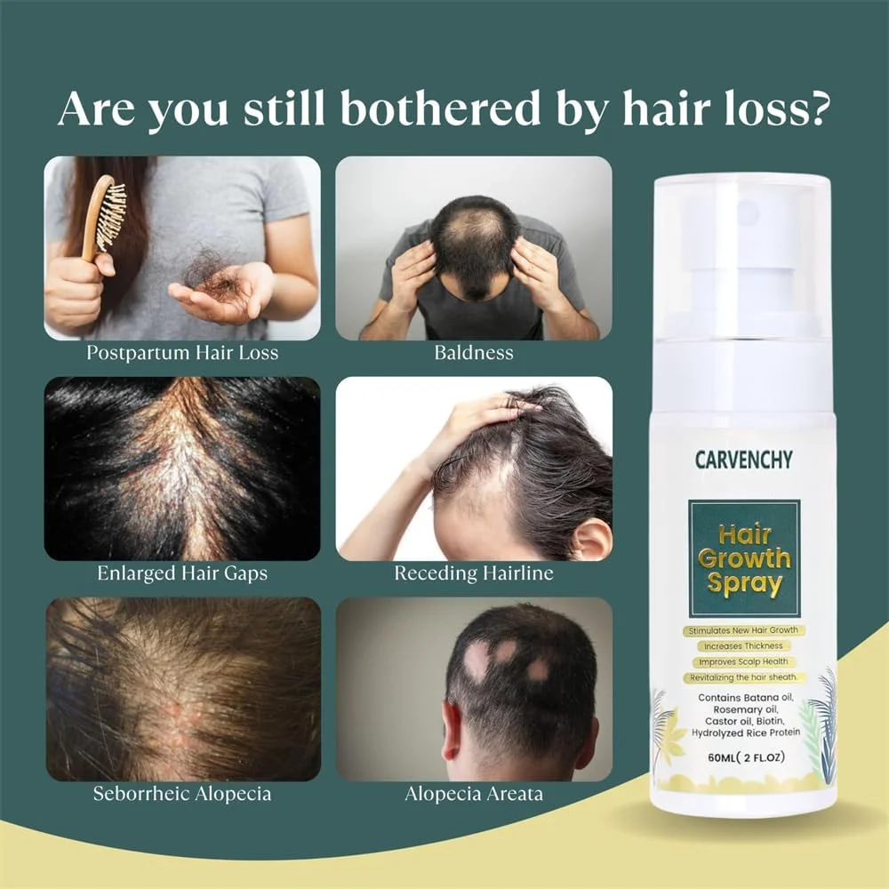 سرم رشد مو آزونه، رشد طبیعی مو برای زنان و مردان، 60 میلی لیتر، غنی شده با روغن باتانا، روغن کرچک، روغن رزماری، برای تغذیه پوست سر و ضخیم شدن مو به طور موثر سرم رشد مو آزونه، رشد طبیعی مو برای زنان و مردان، 60 میلی لیتر، غنی شده با روغن باتانا، روغن کرچک، روغن رزماری، برای تغذیه پوست سر و ضخیم شدن مو به طور موثر