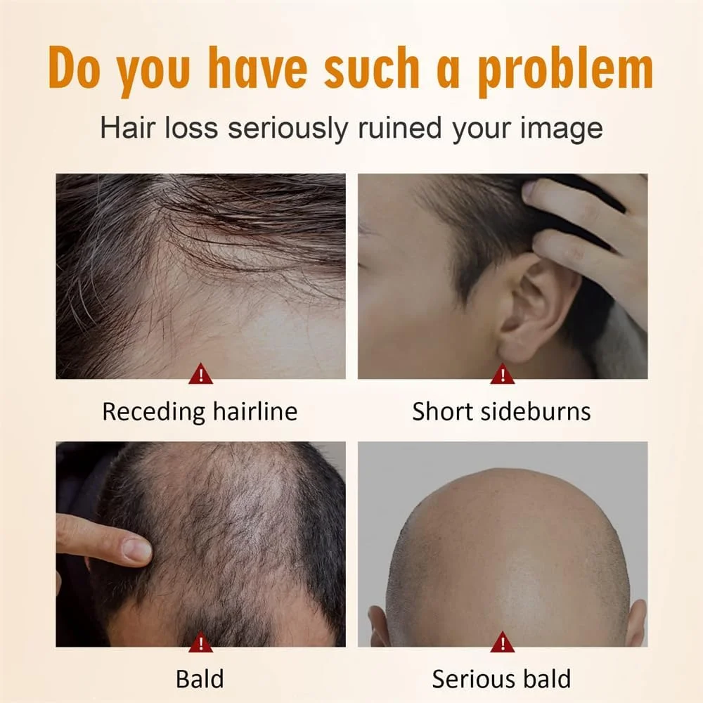 سرم رشد مو زنجبیلی آزونی، درمان 100% طبیعی برای رشد مجدد مو برای مردان و زنان، کاهش دهنده نازک شدن، ریزش مو، شوره سر و خشکی پوست سر، تغذیه کننده و تقویت کننده مو، 60 میلی لیتر سرم رشد مو زنجبیلی آزونی، درمان 100% طبیعی برای رشد مجدد مو برای مردان و زنان، کاهش دهنده نازک شدن، ریزش مو، شوره سر و خشکی پوست سر، تغذیه کننده و تقویت کننده مو، 60 میلی لیتر