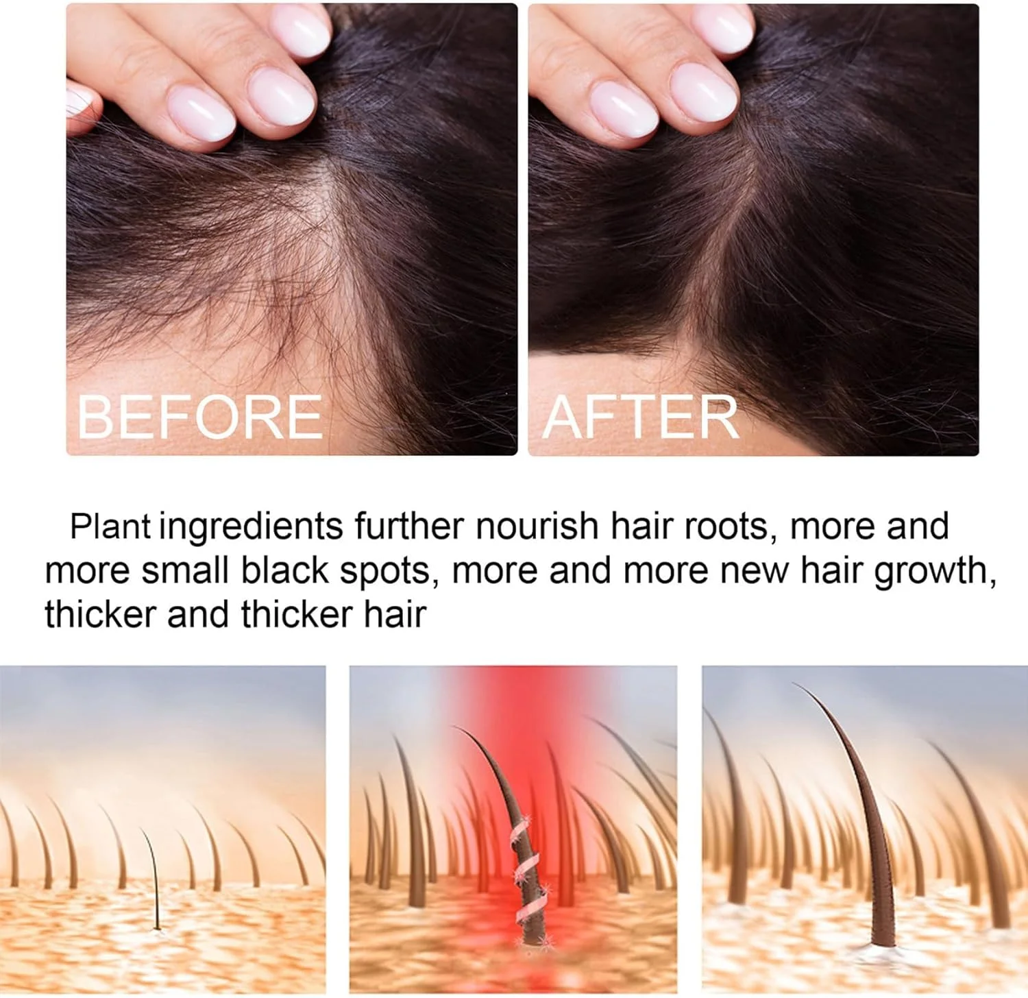 سرم ترمیم و رشد مو زنجبیلی، اسپری تقویت کننده مو آزونی برای جلوگیری از ریزش مو، نازک شدن، خشکی و آسیب دیدگی مو، محلول رشد مجدد، فرمول مغذی با عصاره زنجبیل و گیاهان سرم ترمیم و رشد مو زنجبیلی، اسپری تقویت کننده مو آزونی برای جلوگیری از ریزش مو، نازک شدن، خشکی و آسیب دیدگی مو، محلول رشد مجدد، فرمول مغذی با عصاره زنجبیل و گیاهان