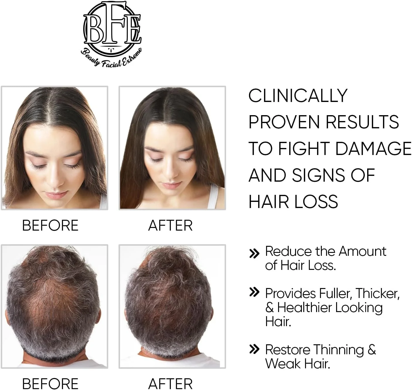 سرم رشد مجدد موی صورت و زیبایی - مسدود کننده DHT با حداکثر قدرت برای مردان و زنان سرم رشد مجدد موی صورت و زیبایی - مسدود کننده DHT با حداکثر قدرت برای مردان و زنان