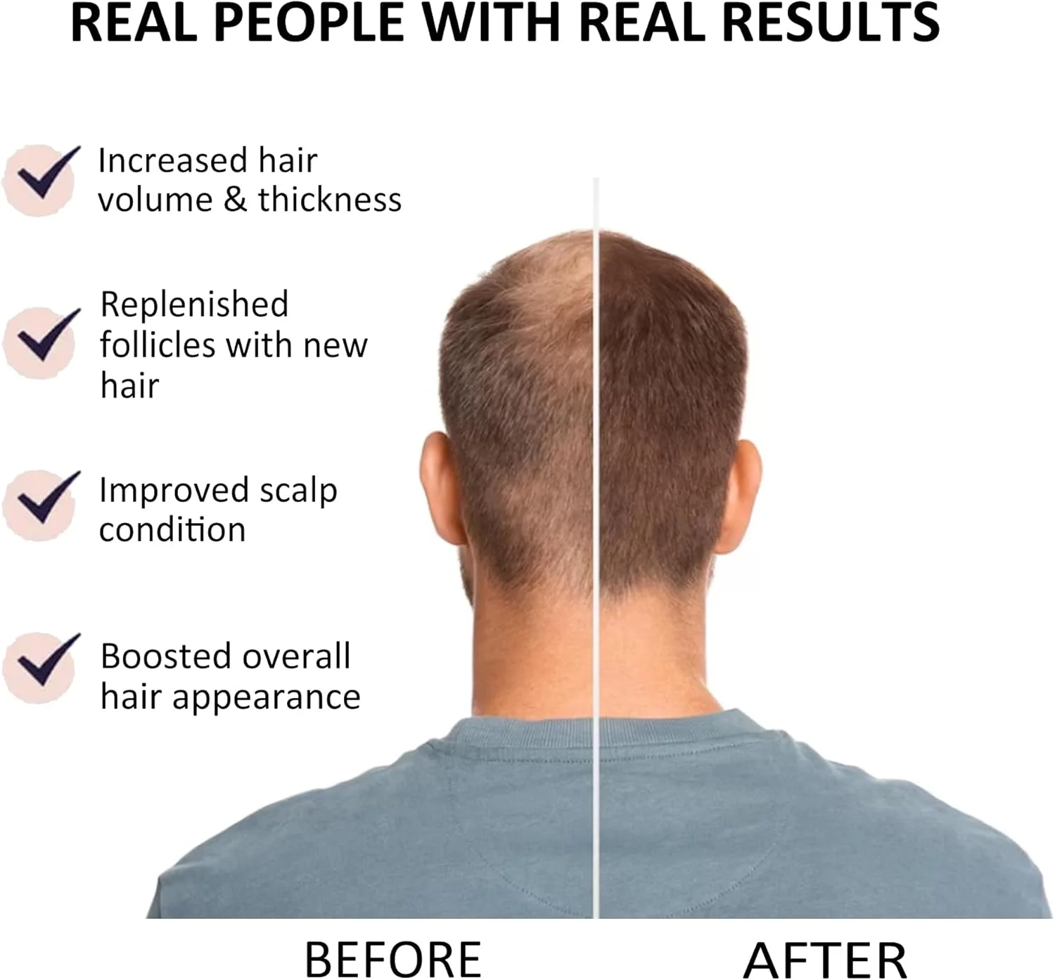 سرم سائو پالمتو بیوتی سکرتز برای زنان و مردان - کاهش ریزش مو، تحریک رشد 30 میلی لیتر | احیا کننده طبیعی رشد مو غنی شده با ردنسل، بیوتین و روغن رزماری سرم سائو پالمتو بیوتی سکرتز برای زنان و مردان - کاهش ریزش مو، تحریک رشد 30 میلی لیتر | احیا کننده طبیعی رشد مو غنی شده با ردنسل، بیوتین و روغن رزماری