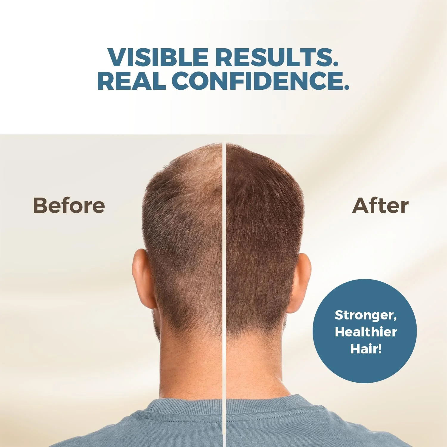 سرم مو Ecklonia Cava - حجم دهنده و تقویت کننده رشد مو برای انواع مو، ژل حالت دهنده با انعطاف پذیری بالا حاوی MSM و بیوتین برای خانم ها و آقایان، 120 میلی لیتر سرم مو Ecklonia Cava - حجم دهنده و تقویت کننده رشد مو برای انواع مو، ژل حالت دهنده با انعطاف پذیری بالا حاوی MSM و بیوتین برای خانم ها و آقایان، 120 میلی لیتر