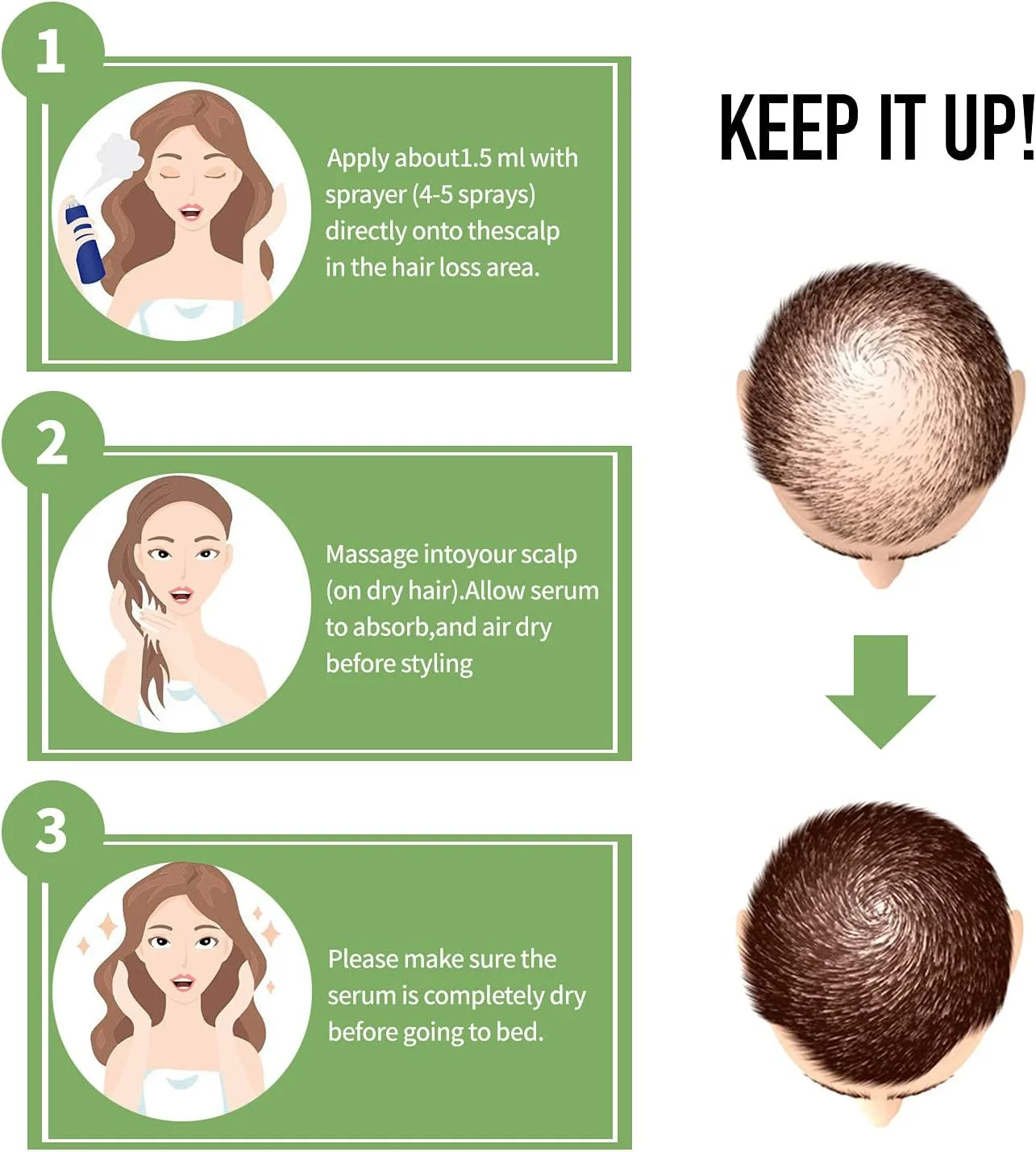 سرم رشد مو ELBBUB - روغن رشد مو برای موهای ضخیم تر و سالم تر، کاهش ریزش مو با بیوتین و فرمول موضعی پیشرفته سرم رشد مو ELBBUB - روغن رشد مو برای موهای ضخیم تر و سالم تر، کاهش ریزش مو با بیوتین و فرمول موضعی پیشرفته