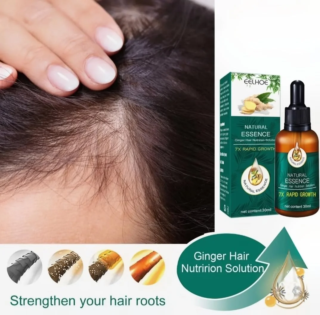 محلول تغذیه مو با عصاره طبیعی زنجبیل EELHOE - رشد سریع 7 برابر - سرم رشد موی طبیعی برای موهای ضخیم تر، 30 میلی لیتر محلول تغذیه مو با عصاره طبیعی زنجبیل EELHOE - رشد سریع 7 برابر - سرم رشد موی طبیعی برای موهای ضخیم تر، 30 میلی لیتر