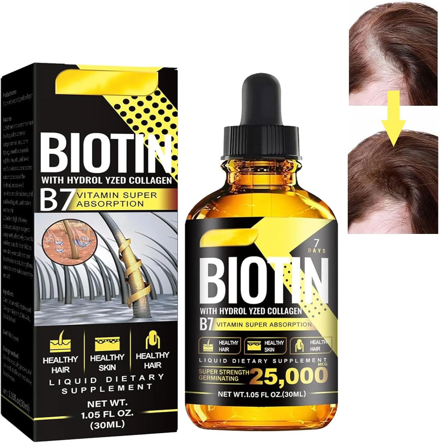 سرم رشد مو، رشد مو، ضد ریزش مو، سرم رشد مو 30 میلی لیتری، سرم رشد مو برای زنان و مردان، برای موهای نازک، ضخیم کننده و احیا کننده، برای رشد سریع مو