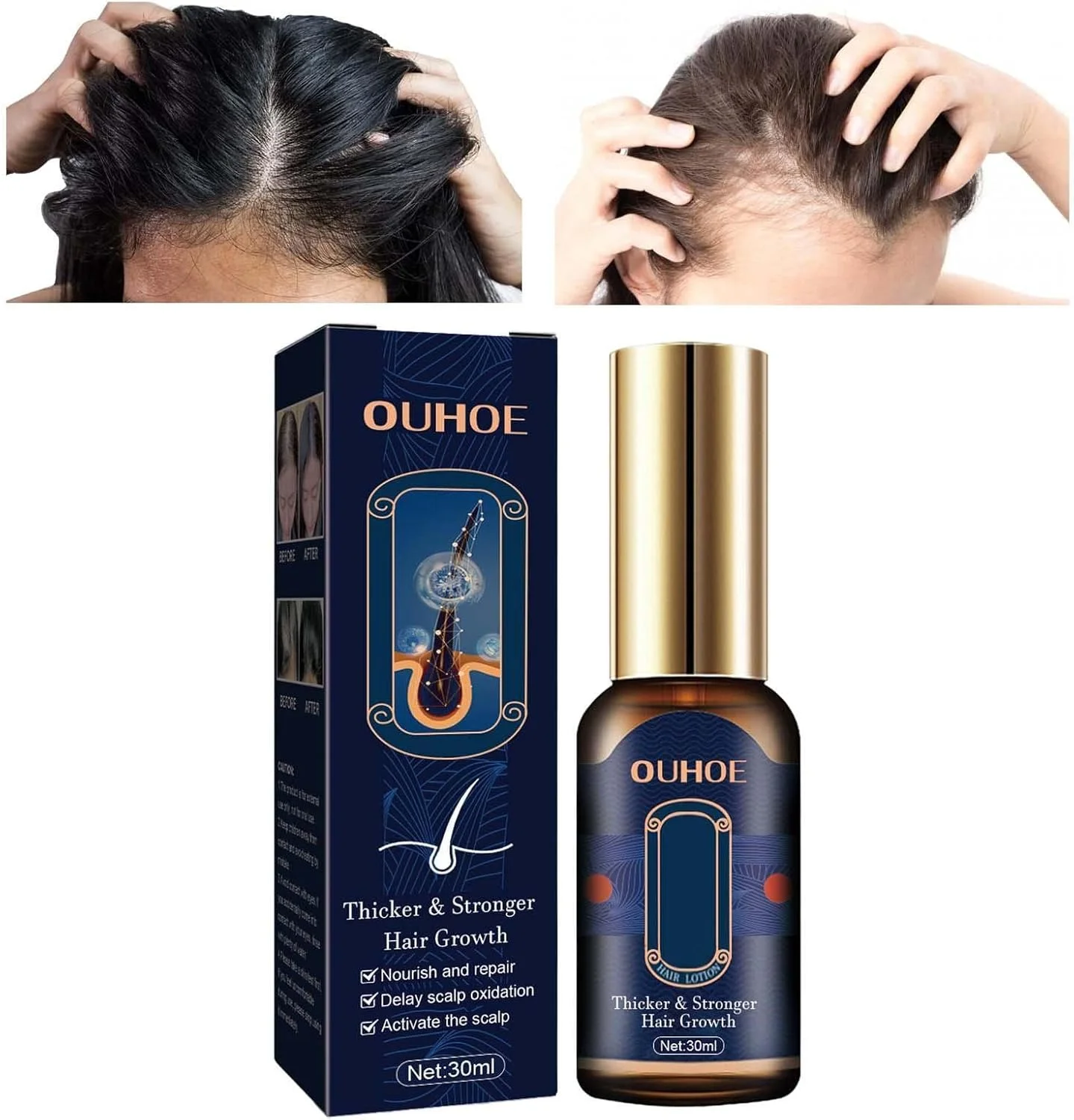 سرم های رشد مو | نرم کننده عمیق ترمیم کننده موهای آسیب دیده | سرم های رشد مو 30 میلی لیتری برای مردان و زنان، رشد مو، درمان ریزش مو