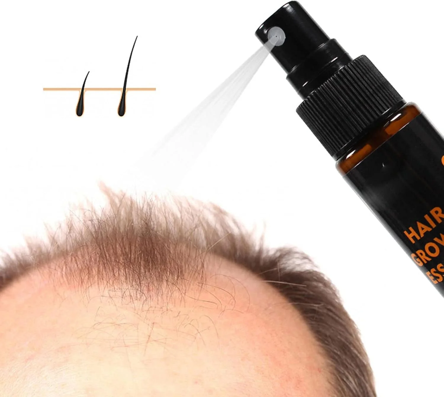 اسپری سرم رشد مو 30 میلی لیتری، مایع احیا کننده مو مراقبت از پوست سر - مرطوب کننده تغذیه کننده فولیکول ها، محافظت از ریشه مو اسپری سرم رشد مو 30 میلی لیتری، مایع احیا کننده مو مراقبت از پوست سر - مرطوب کننده تغذیه کننده فولیکول ها، محافظت از ریشه مو