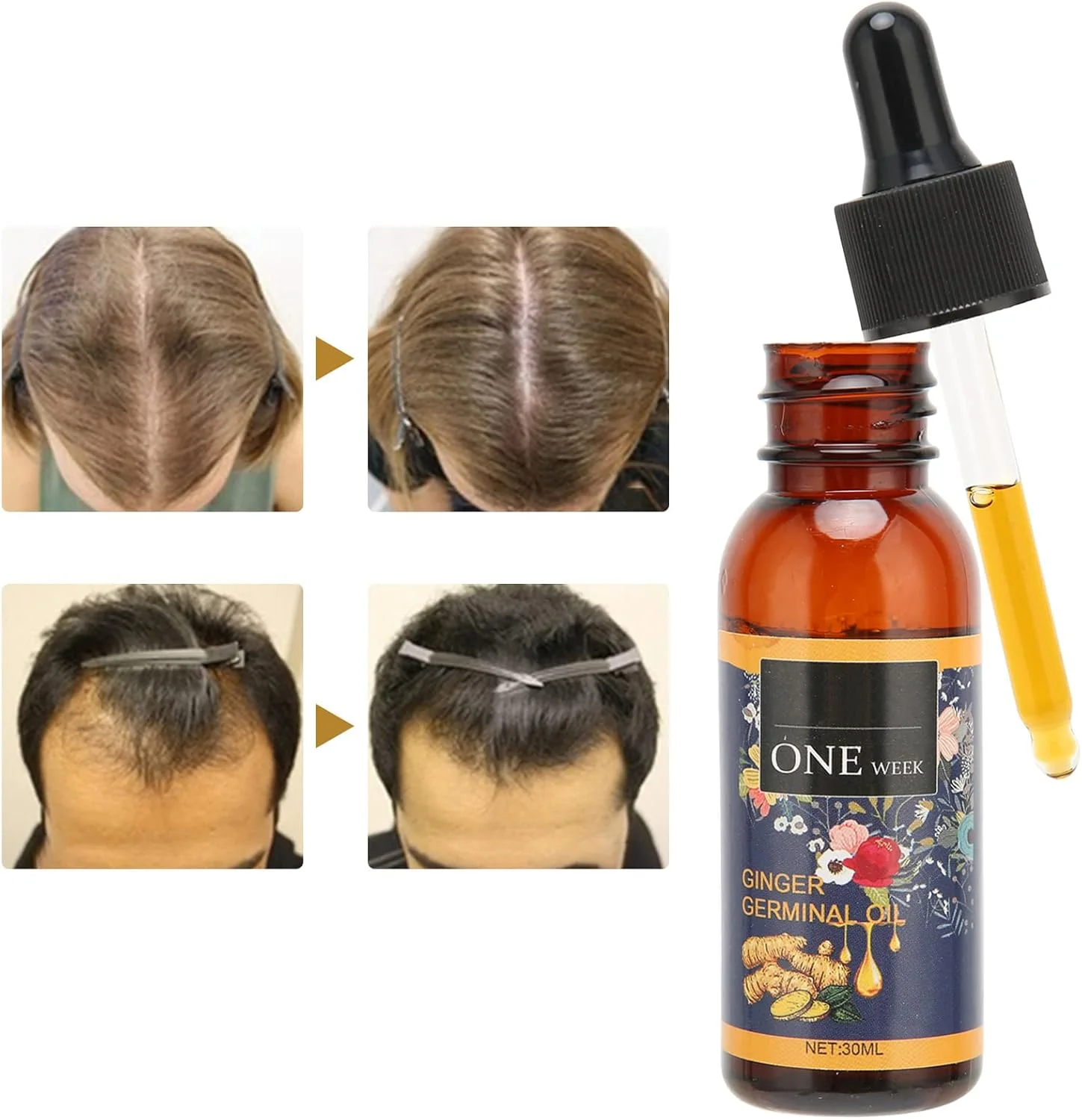 سرم رشد مو، سرم زنجبیل حرفه ای صاف کننده مو برای موهای آسیب دیده سرم رشد مو، سرم زنجبیل حرفه ای صاف کننده مو برای موهای آسیب دیده