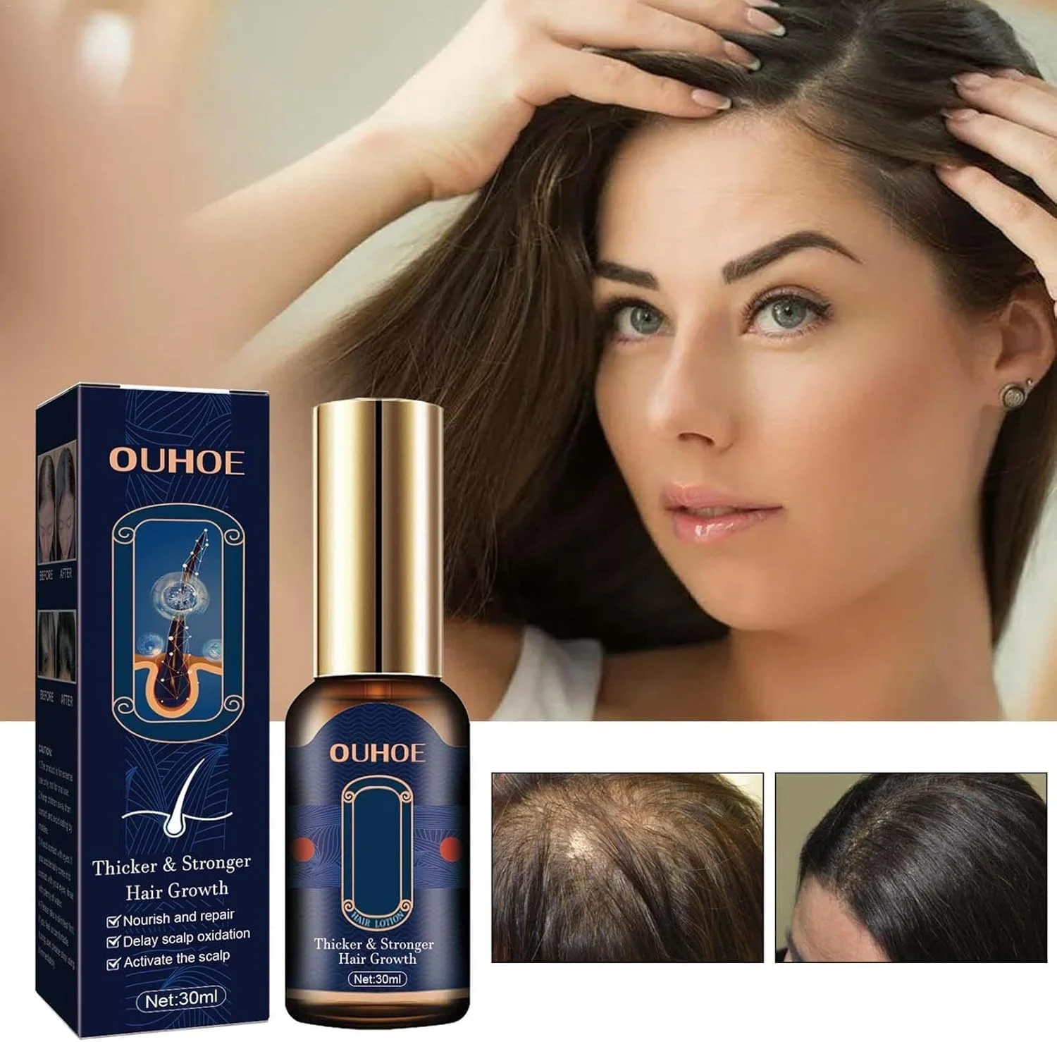 سرم های رشد مو | نرم کننده عمیق ترمیم کننده موهای آسیب دیده | سرم های رشد مو 30 میلی لیتری برای مردان و زنان، رشد مو، درمان ریزش مو سرم های رشد مو | نرم کننده عمیق ترمیم کننده موهای آسیب دیده | سرم های رشد مو 30 میلی لیتری برای مردان و زنان، رشد مو، درمان ریزش مو