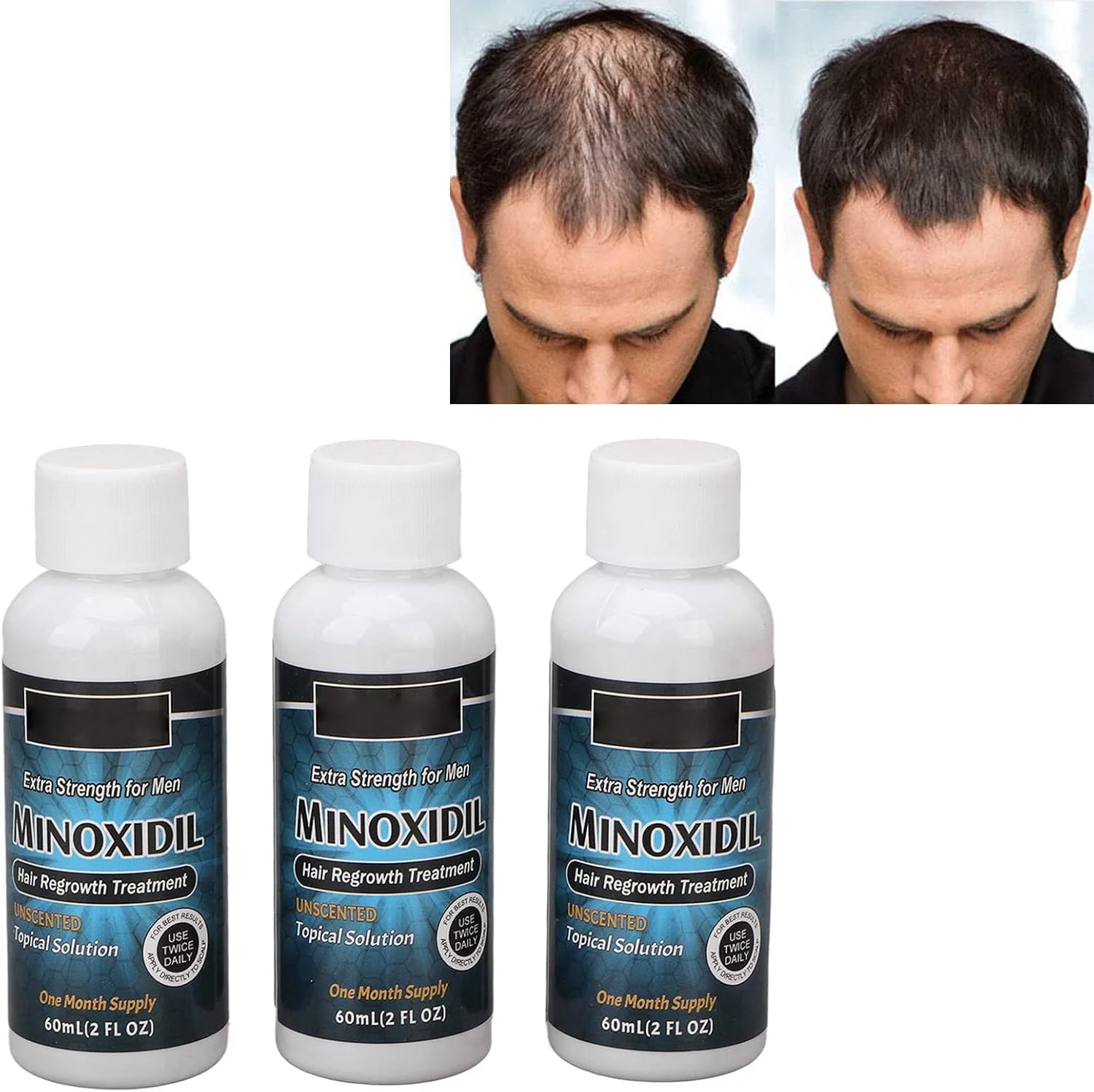 سرم رشد مو، ضد ریزش مو، سرم مراقبت از ریش مغذی ملایم برای موهای نازک آقایان، 3 عدد 60 میلی لیتر سرم رشد مو، ضد ریزش مو، سرم مراقبت از ریش مغذی ملایم برای موهای نازک آقایان، 3 عدد 60 میلی لیتر