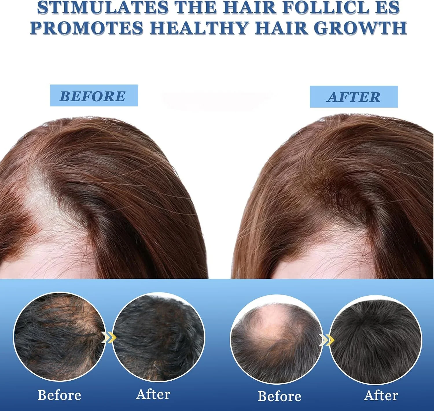 سرم رشد مو، لوسیون مو سرم رشد مو، لوسیون رشد مجدد مو مراقبت از رشد مو، سرم رشد مو 20 گرمی، سرم رشد مو، پماد رشد مو سرم رشد مو، لوسیون مو سرم رشد مو، لوسیون رشد مجدد مو مراقبت از رشد مو، سرم رشد مو 20 گرمی، سرم رشد مو، پماد رشد مو