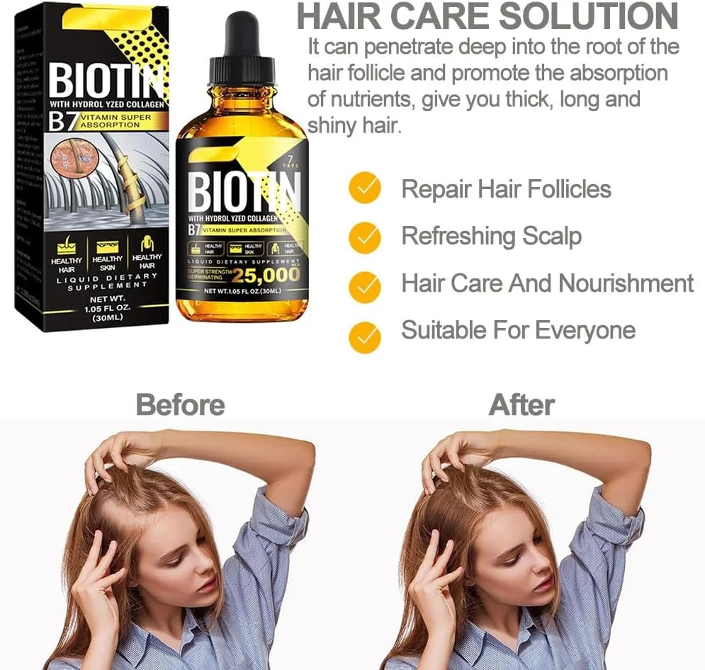 سرم رشد مو، رشد مو، ضد ریزش مو، سرم رشد مو 30 میلی لیتری، سرم رشد مو برای زنان و مردان، برای موهای نازک، ضخیم کننده و احیا کننده، برای رشد سریع مو سرم رشد مو، رشد مو، ضد ریزش مو، سرم رشد مو 30 میلی لیتری، سرم رشد مو برای زنان و مردان، برای موهای نازک، ضخیم کننده و احیا کننده، برای رشد سریع مو