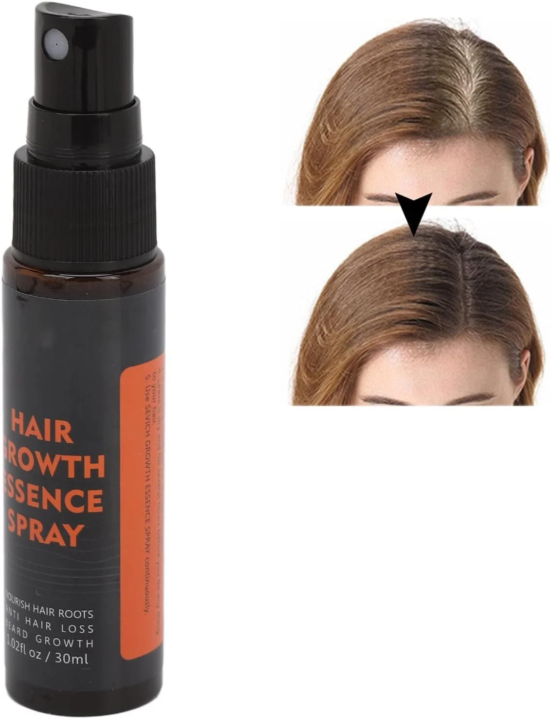 اسپری سرم رشد مو 30 میلی لیتری، مایع احیا کننده مو مراقبت از پوست سر - مرطوب کننده تغذیه کننده فولیکول ها، محافظت از ریشه مو اسپری سرم رشد مو 30 میلی لیتری، مایع احیا کننده مو مراقبت از پوست سر - مرطوب کننده تغذیه کننده فولیکول ها، محافظت از ریشه مو