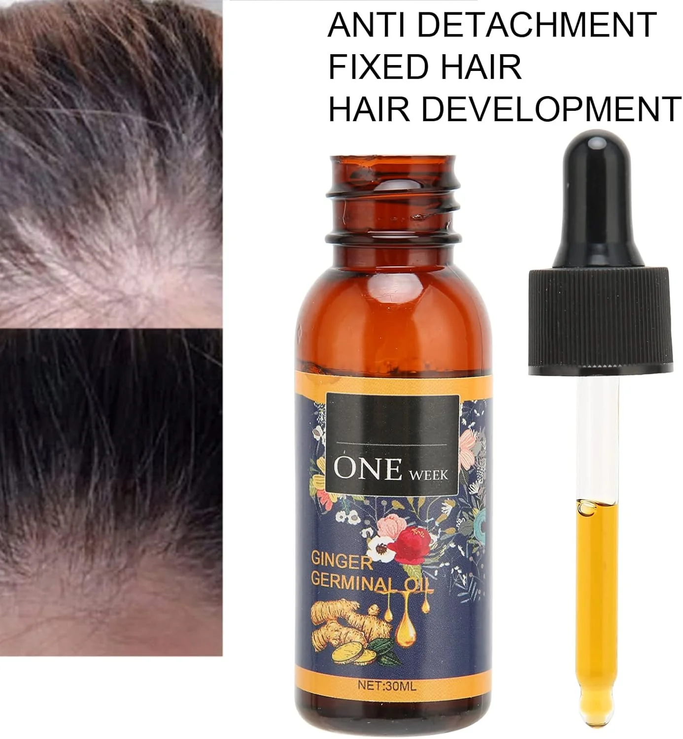 سرم رشد مو، سرم زنجبیل حرفه ای صاف کننده مو برای موهای آسیب دیده سرم رشد مو، سرم زنجبیل حرفه ای صاف کننده مو برای موهای آسیب دیده