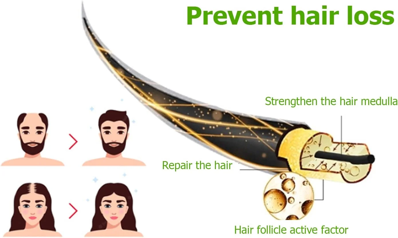 اسپری رشد مو، تقویت کننده ملایم و مغذی برای مراقبت روزانه مو برای آقایان و بانوان اسپری رشد مو، تقویت کننده ملایم و مغذی برای مراقبت روزانه مو برای آقایان و بانوان