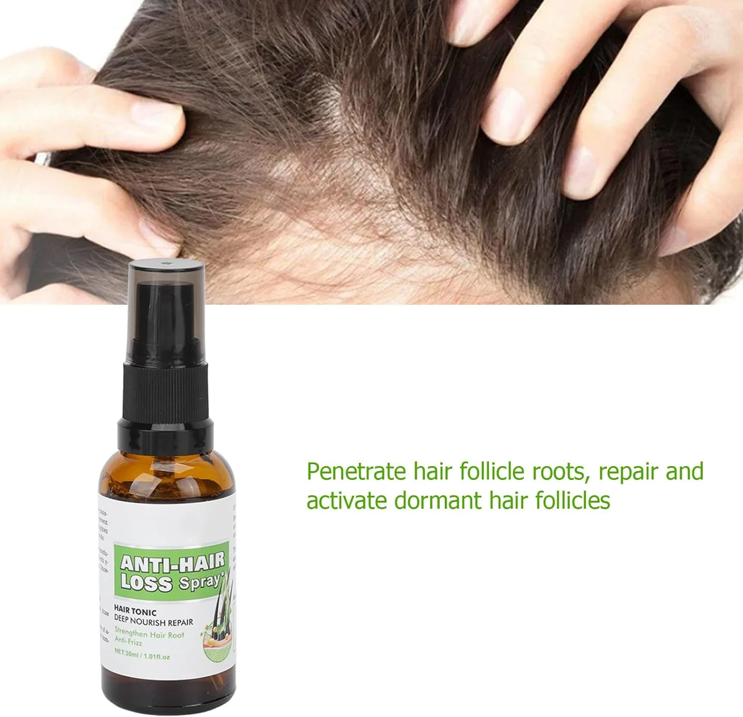 اسپری رشد مو، تقویت کننده ملایم و مغذی برای مراقبت روزانه مو برای آقایان و بانوان اسپری رشد مو، تقویت کننده ملایم و مغذی برای مراقبت روزانه مو برای آقایان و بانوان