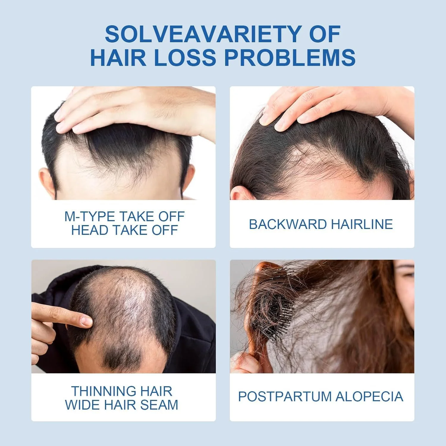 سرم رشد مو، سرم مو 120 میلی لیتری برای رشد مو، رشد طبیعی مو برای مردان و زنان، تقویت مو و جلوگیری از ریزش مو، هدیه برای مردان و زنان سرم رشد مو، سرم مو 120 میلی لیتری برای رشد مو، رشد طبیعی مو برای مردان و زنان، تقویت مو و جلوگیری از ریزش مو، هدیه برای مردان و زنان