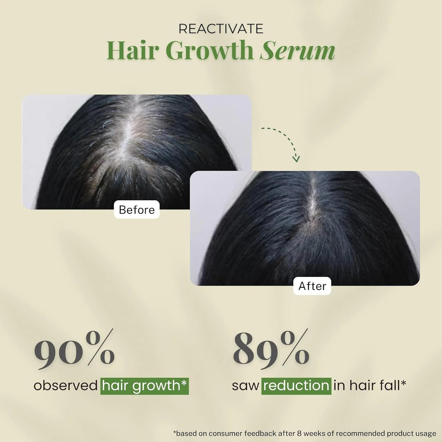 سرم احیا کننده رشد مو لیتل اکسترا حاوی 2% رزماری، آناگین، رِدِنسیل، پروکاپیل و بایکاپیل، بطری 30 میلی لیتری، مناسب برای انواع مو، 100 گرم سرم احیا کننده رشد مو لیتل اکسترا حاوی 2% رزماری، آناگین، رِدِنسیل، پروکاپیل و بایکاپیل، بطری 30 میلی لیتری، مناسب برای انواع مو، 100 گرم