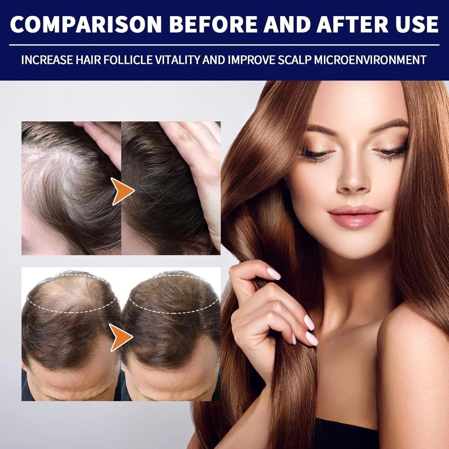 محلول ضد ریزش مو Liascy، درمان ضد نازک شدن مو، درمان رشد مجدد مو برای مردان و زنان، روغن رشد مو، سرم رشد مو برای ریزش مو، موهای نازک (3 جعبه) محلول ضد ریزش مو Liascy، درمان ضد نازک شدن مو، درمان رشد مجدد مو برای مردان و زنان، روغن رشد مو، سرم رشد مو برای ریزش مو، موهای نازک (3 جعبه)