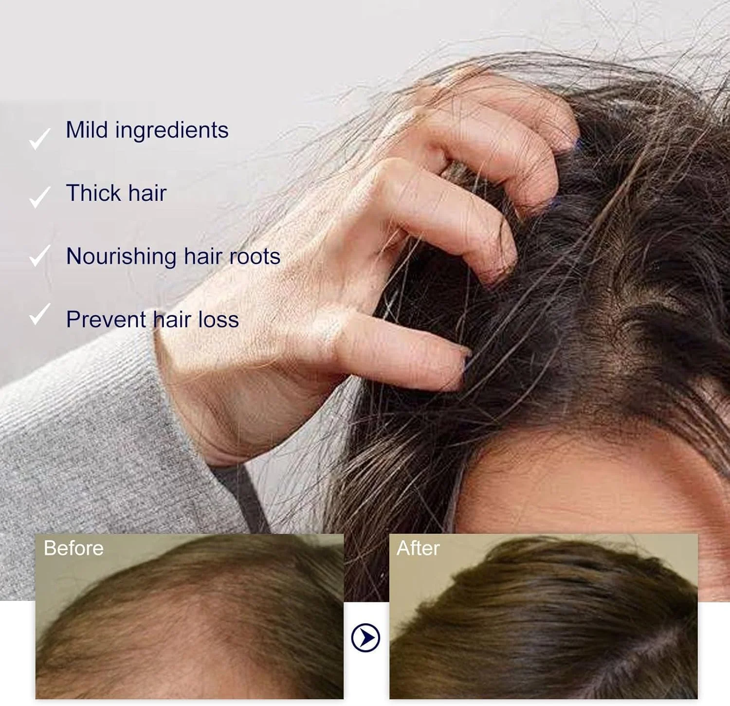 سرم پپتید مس برای رشد مو LBOYLOVE®، فرمول پپتیدی ضد ریزش مو، روغن رشد مجدد مو برای مردان و زنان، اسانس مغذی و ضخیم کننده ضد ریزش مو برای موهای قوی تر، ضخیم تر و بلندتر سرم پپتید مس برای رشد مو LBOYLOVE®، فرمول پپتیدی ضد ریزش مو، روغن رشد مجدد مو برای مردان و زنان، اسانس مغذی و ضخیم کننده ضد ریزش مو برای موهای قوی تر، ضخیم تر و بلندتر