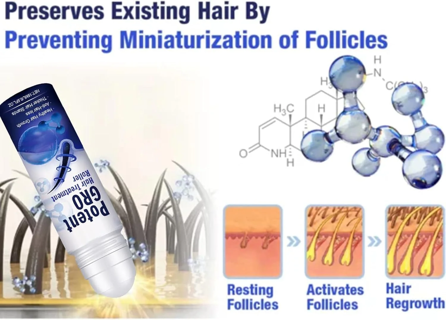 غلتک درمان موی مشکی Lezpzay، سرم رشد مجدد مو برای مردان و زنان، درمان ریزش مو برای موهای پرپشت تر و ضخیم تر، بسته 2 عددی غلتک درمان موی مشکی Lezpzay، سرم رشد مجدد مو برای مردان و زنان، درمان ریزش مو برای موهای پرپشت تر و ضخیم تر، بسته 2 عددی