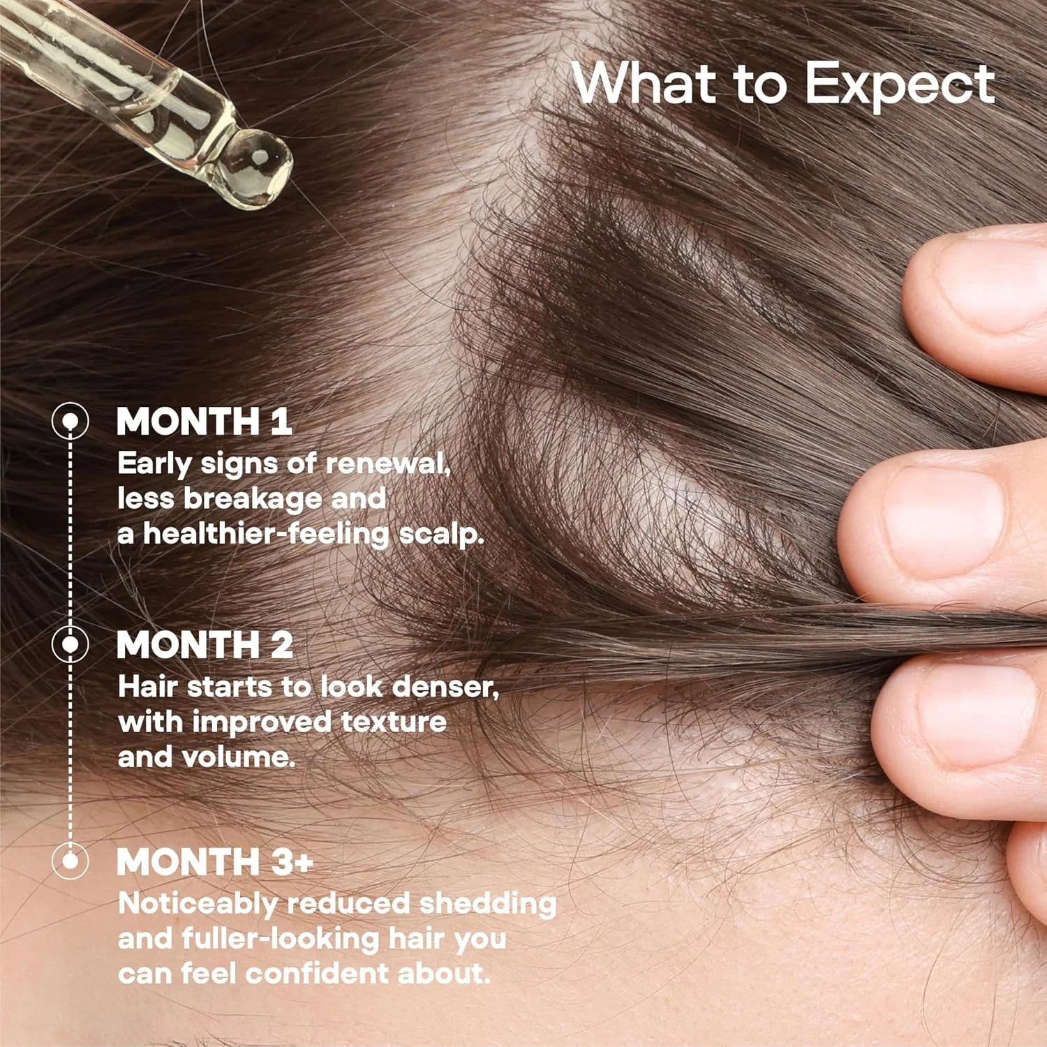 سرم رشد مو ONYX ProGro LactoPherma برای زنان و مردان - فرمول بدون روغن با 12 ماده فعال - تقویت کننده رشد مجدد، ضخیم کننده مو، کاهش ریزش و نازک شدن مو، تحریک گردش خون پوست سر