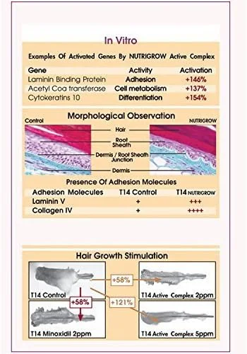سرم ضد ریزش مو و افزایش سرعت رشد مو نوتریگرو 180 میلی لیتر