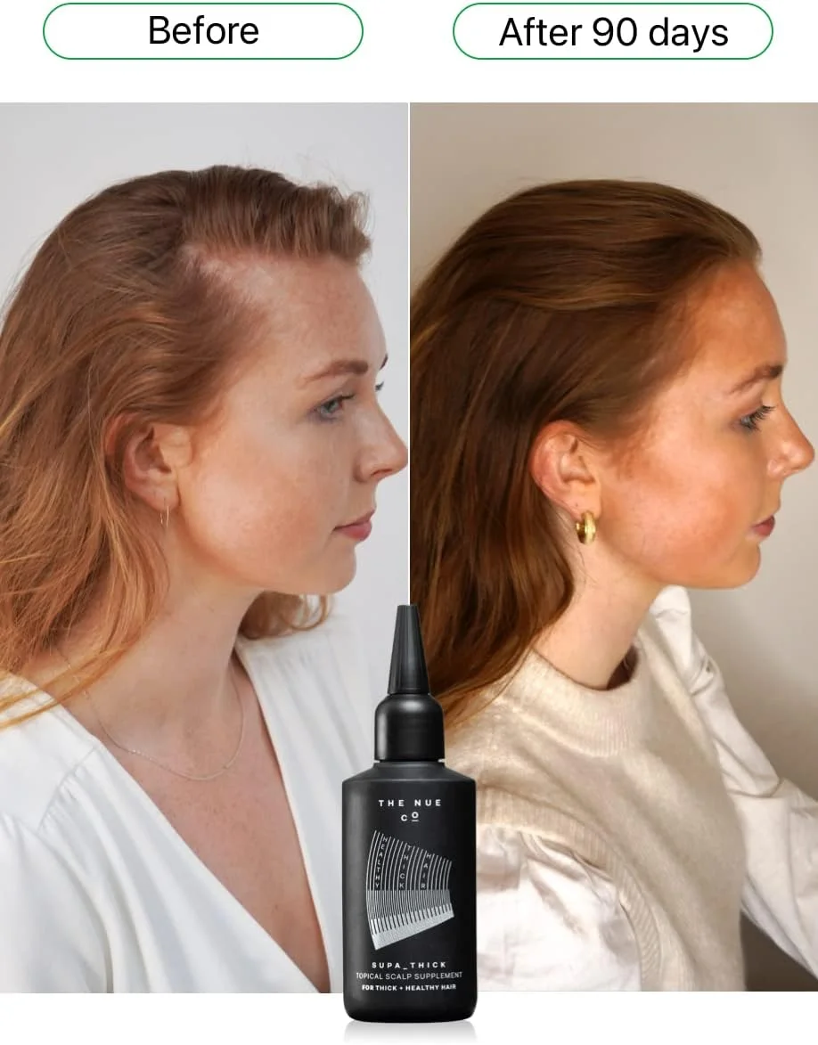 سرم درمان پوست سر ضخیم کننده نو کو SUPA THICK؛ رشد مو، موهای ضخیم سالم، ضد شوره سر - وگان، بدون تست حیوانی سرم درمان پوست سر ضخیم کننده نو کو SUPA THICK؛ رشد مو، موهای ضخیم سالم، ضد شوره سر - وگان، بدون تست حیوانی