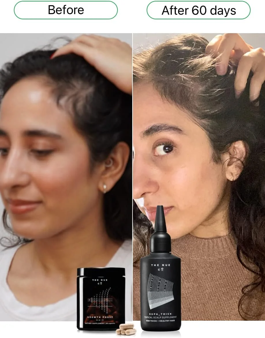 سرم درمان پوست سر ضخیم کننده نو کو SUPA THICK؛ رشد مو، موهای ضخیم سالم، ضد شوره سر - وگان، بدون تست حیوانی سرم درمان پوست سر ضخیم کننده نو کو SUPA THICK؛ رشد مو، موهای ضخیم سالم، ضد شوره سر - وگان، بدون تست حیوانی